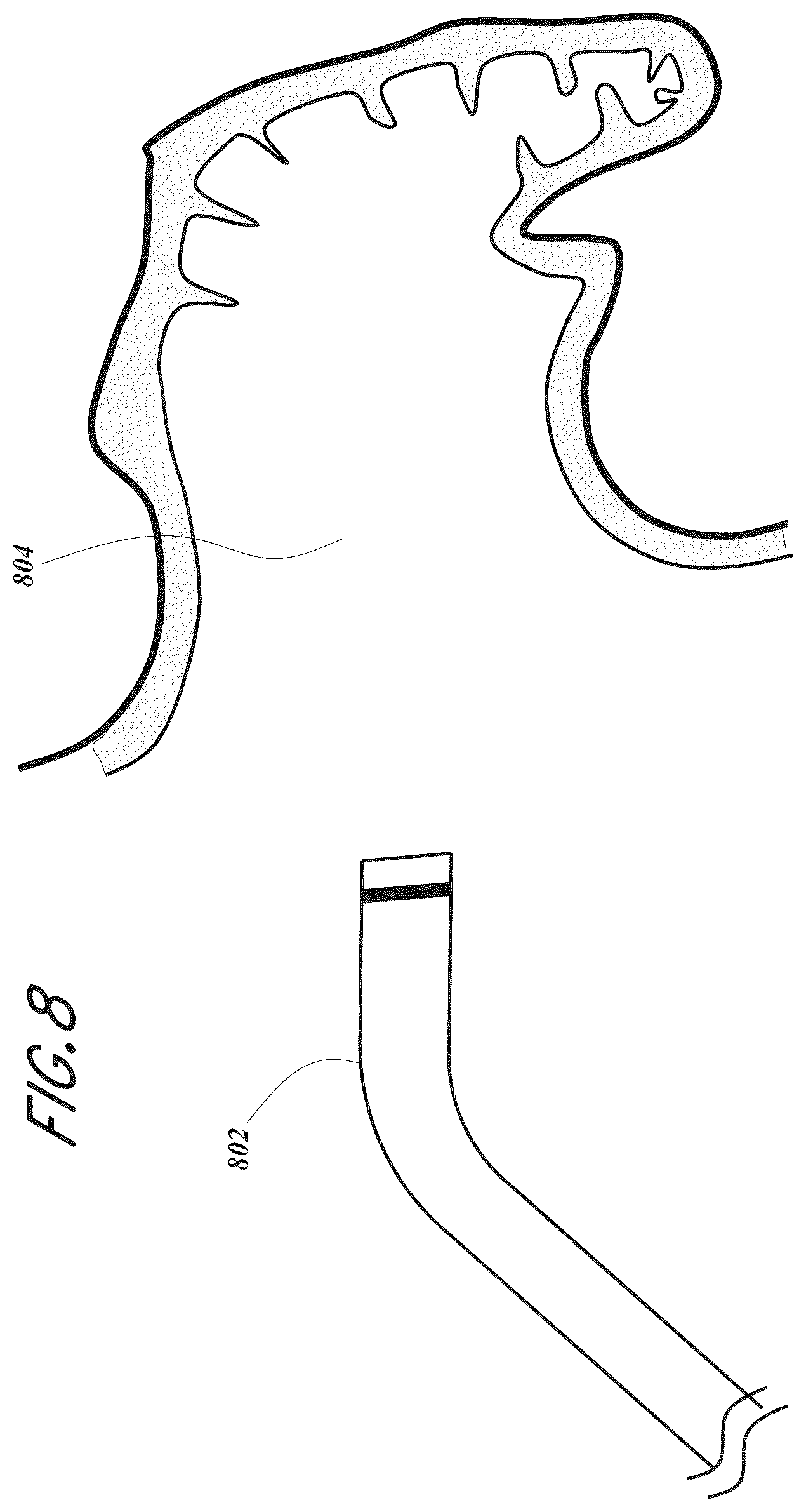 Patent US12167856 Figure 8 – Devices and methods for excluding the left atrial appendage