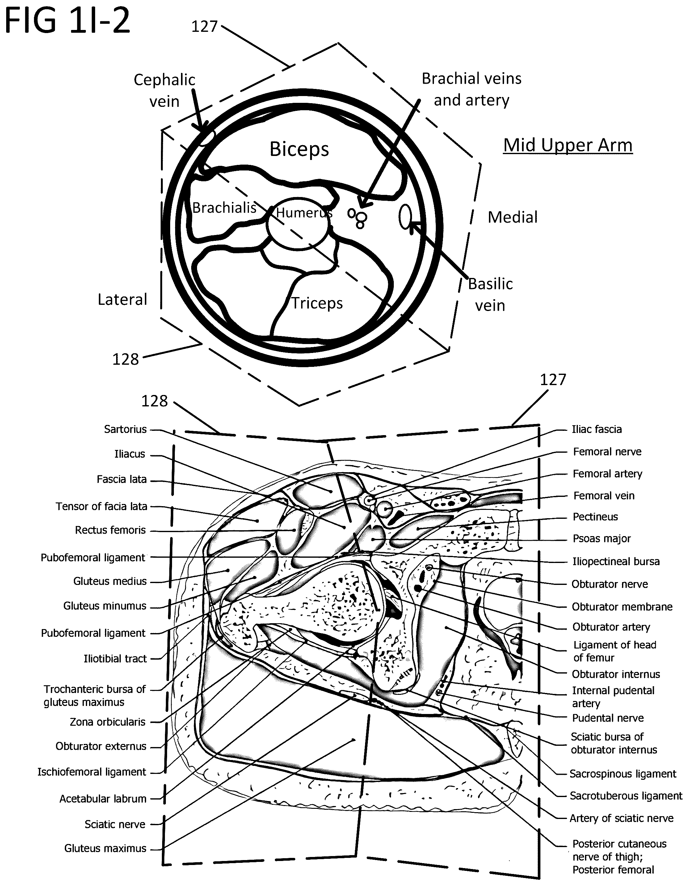Patent US12167858 Figure 8 – Barrel inflatable belt