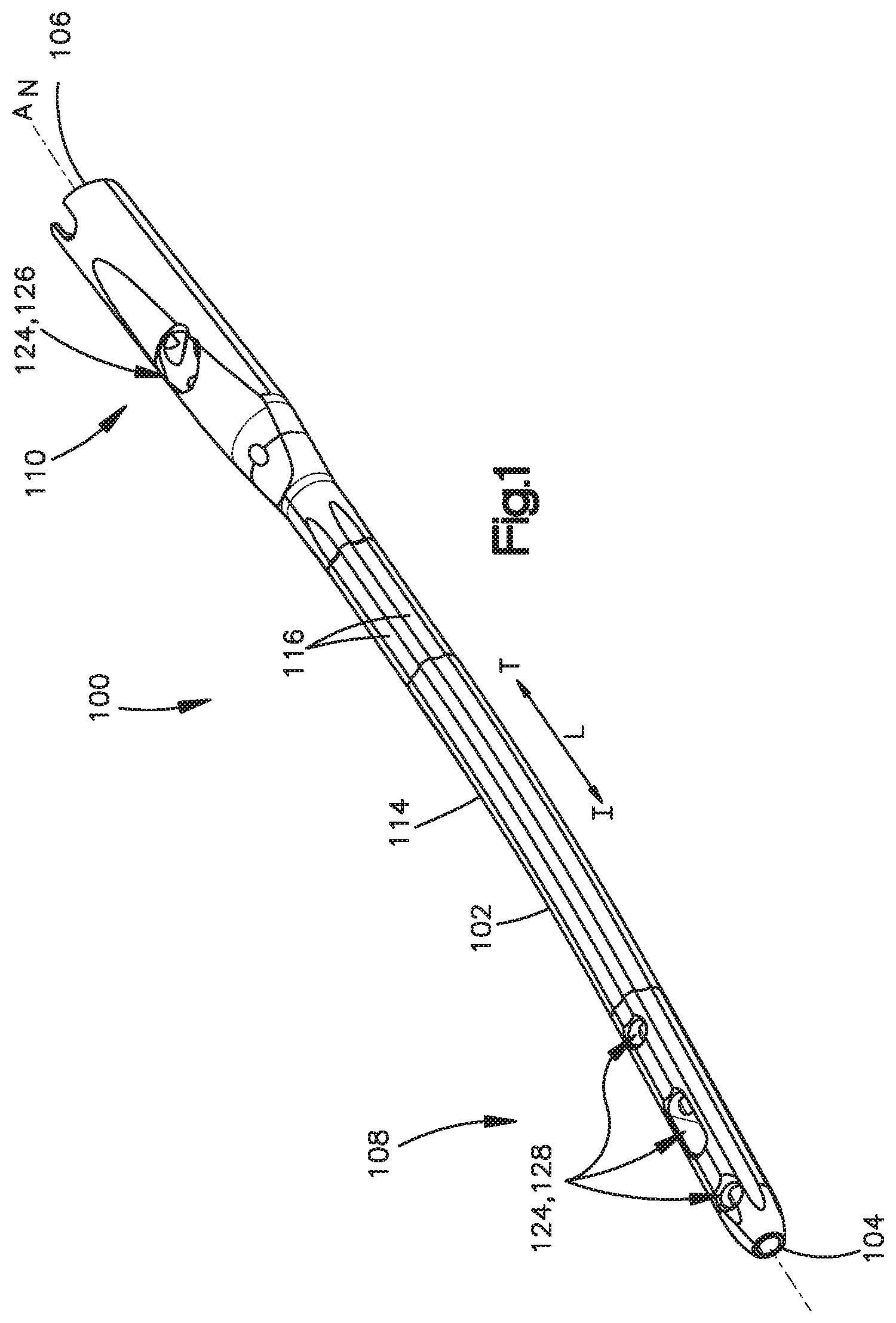 Patent US12167859 — Intramedullary nail with wire or magnet for targeting of a bone-anchor locking hole — Figure 1