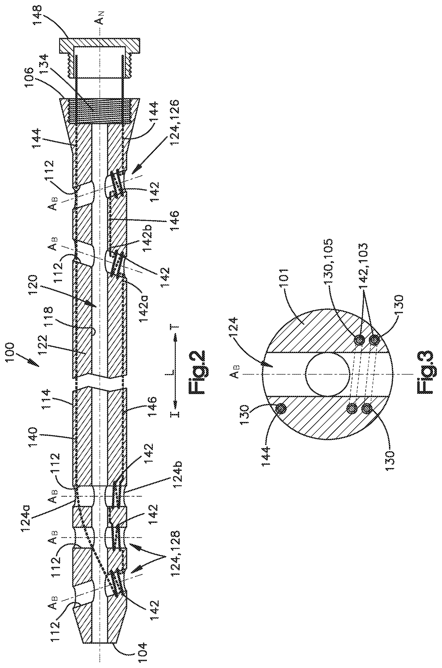Patent US12167859 Figure 2 – Intramedullary nail with wire or magnet for targeting of a bone-anchor locking hole