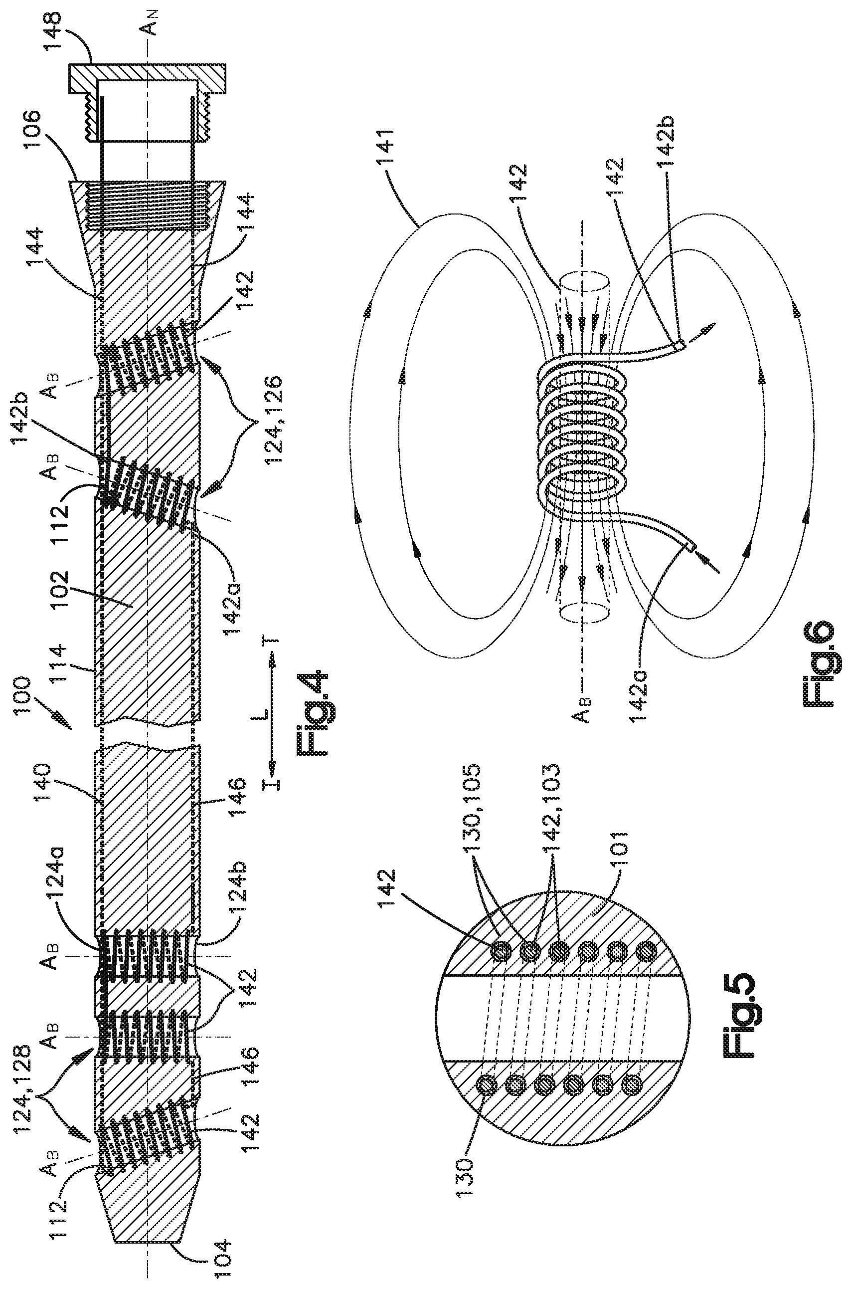Patent US12167859 Figure 3 – Intramedullary nail with wire or magnet for targeting of a bone-anchor locking hole