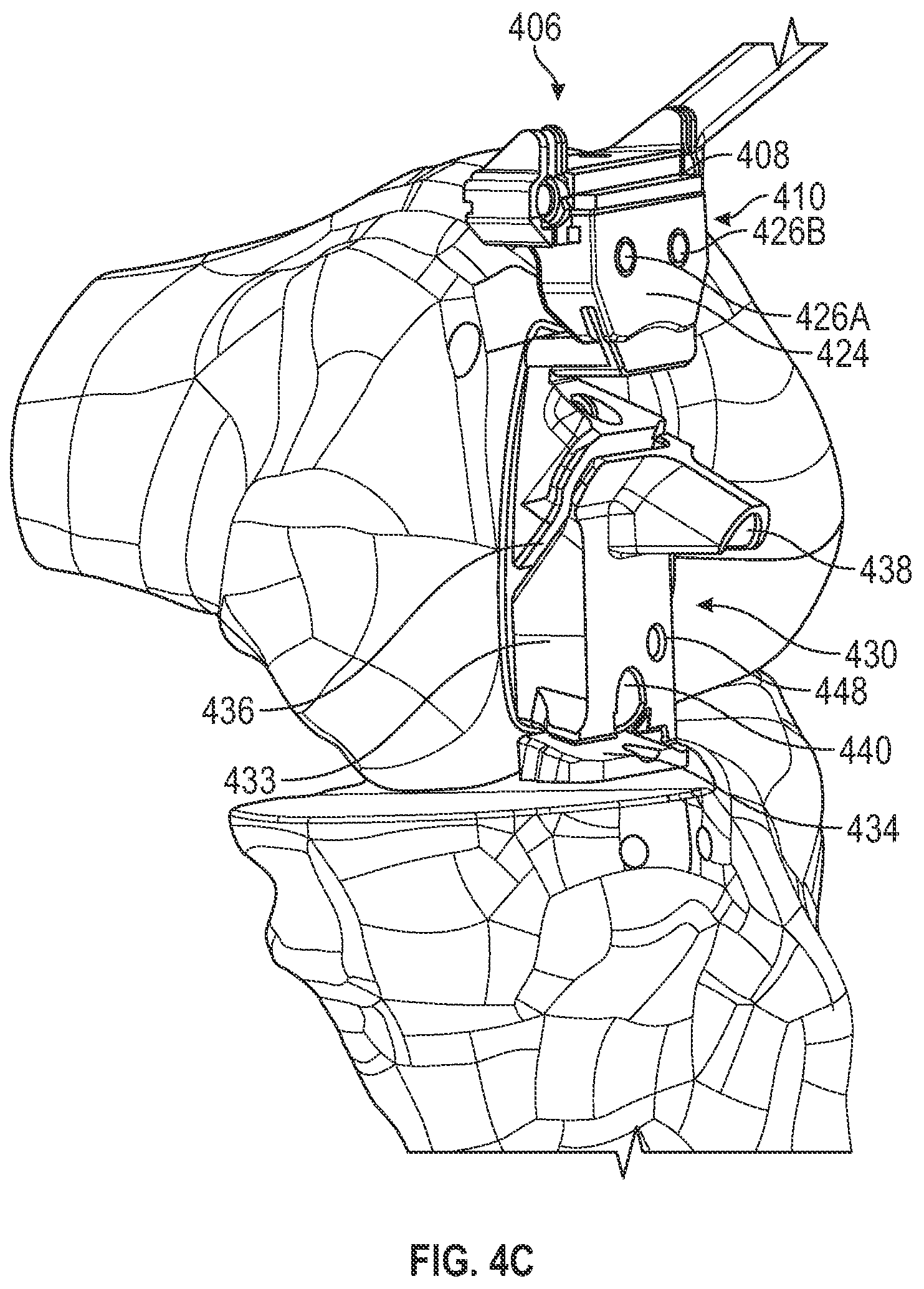 Patent US12167860 Figure 7 – Devices and methods for posterior resection in robotically assisted partial knee arthroplasties