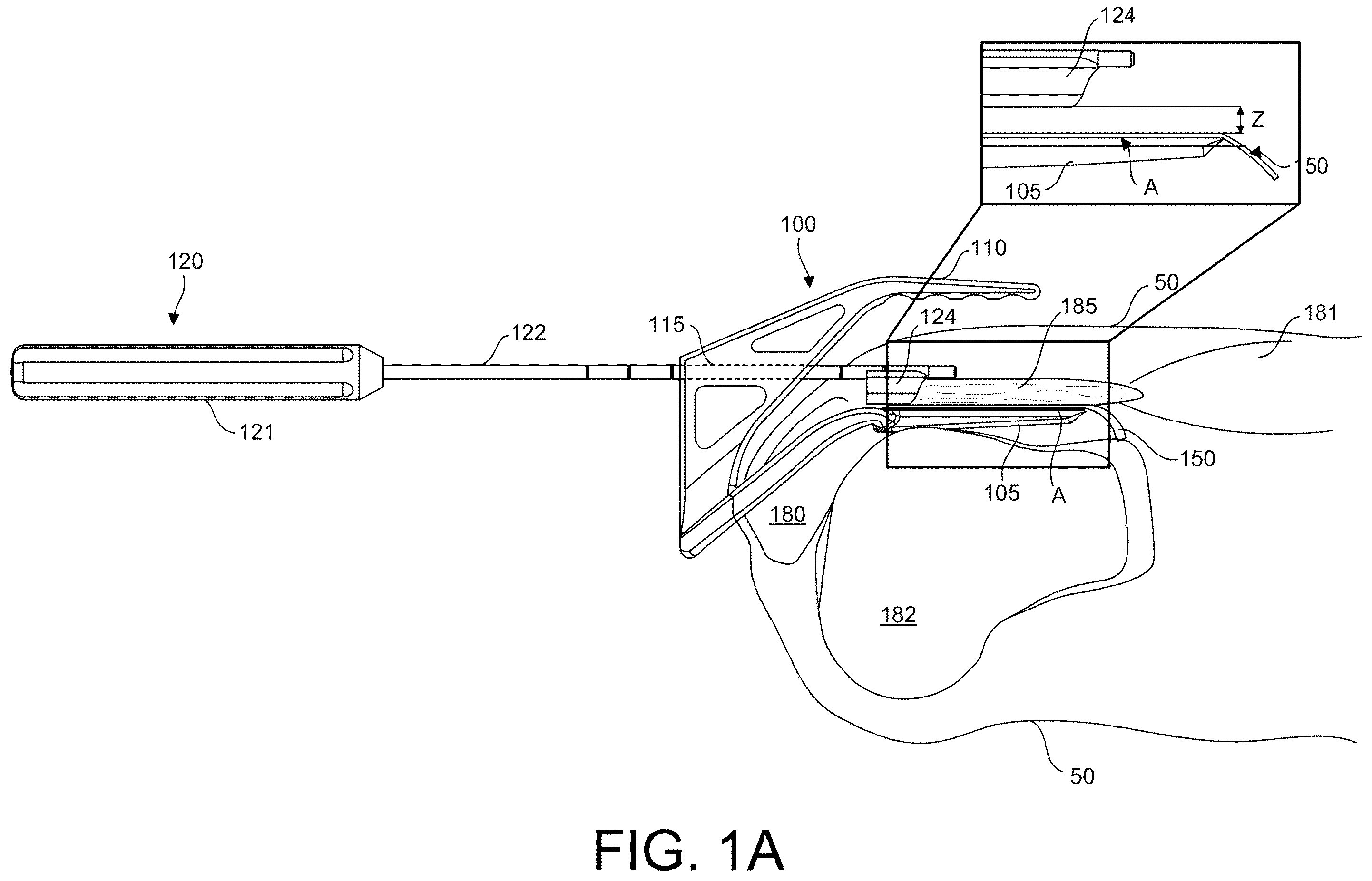 Patent US12167861 Figure 1 – Tendon harvesting system