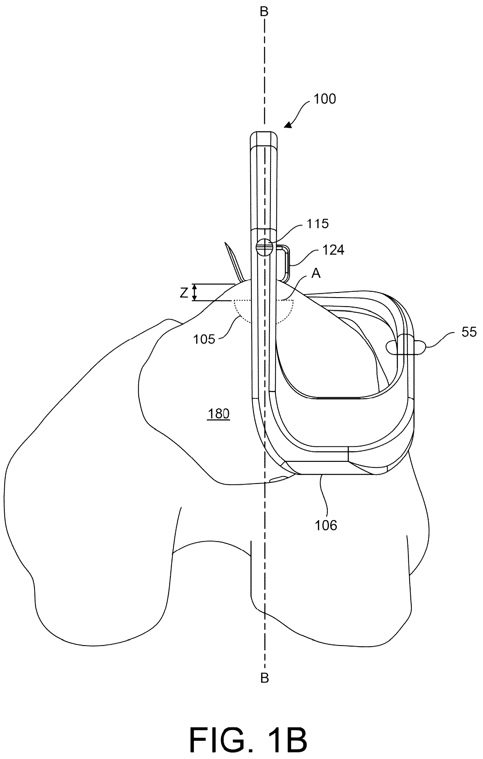 Patent US12167861 Figure 2 – Tendon harvesting system