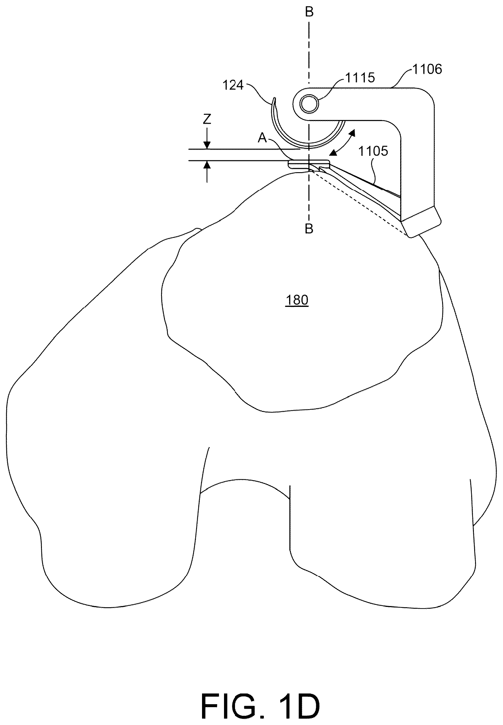 Patent US12167861 Figure 4 – Tendon harvesting system