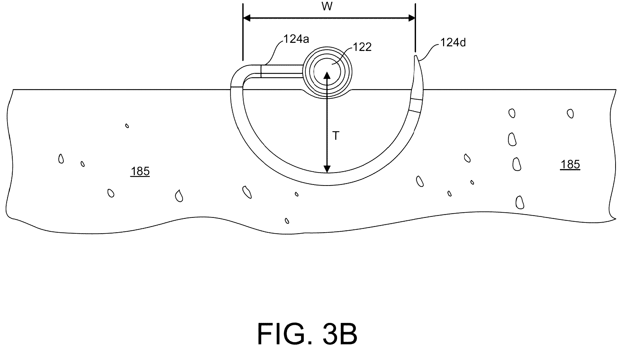 Patent US12167861 Figure 13 – Tendon harvesting system