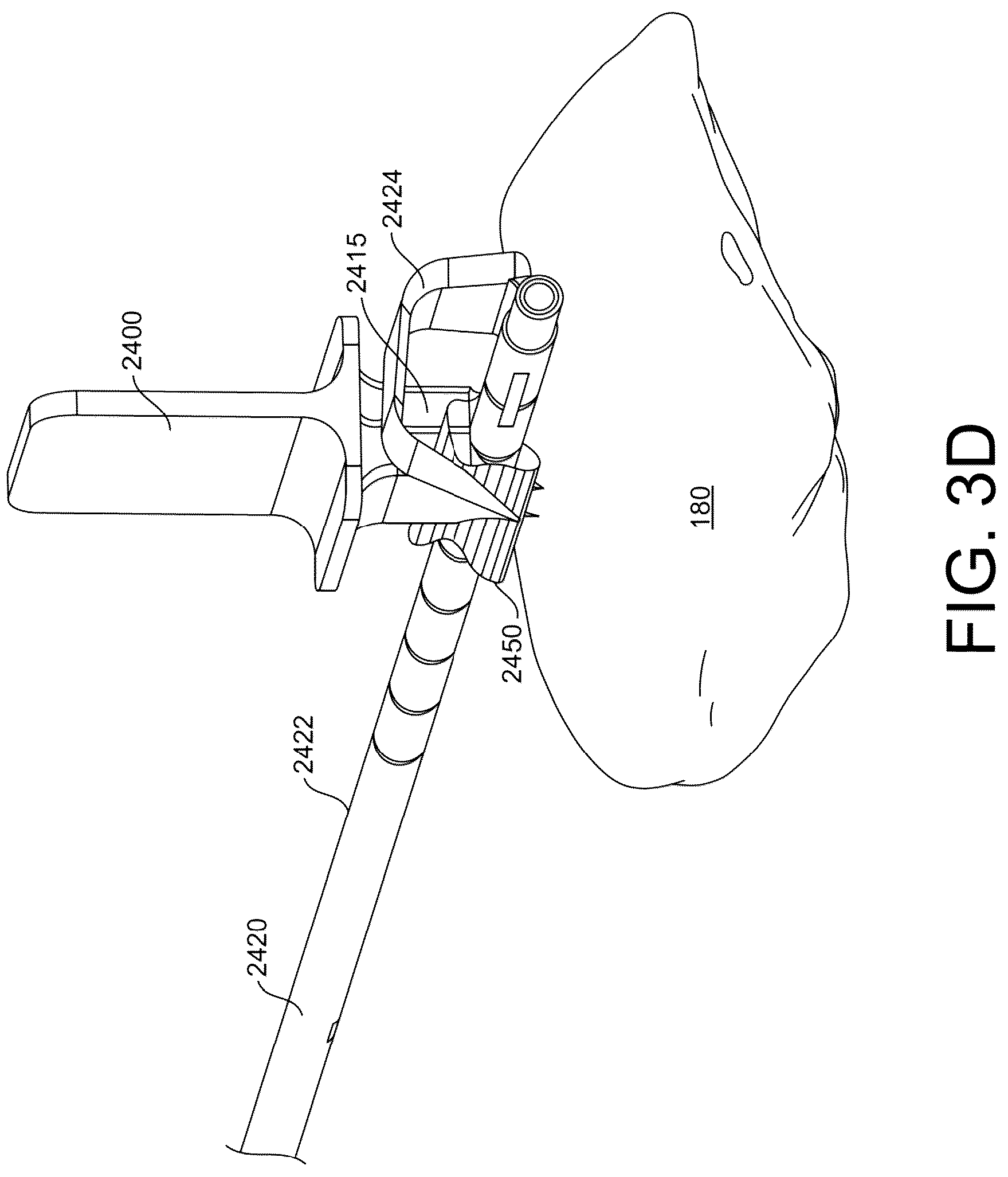 Patent US12167861 Figure 15 – Tendon harvesting system