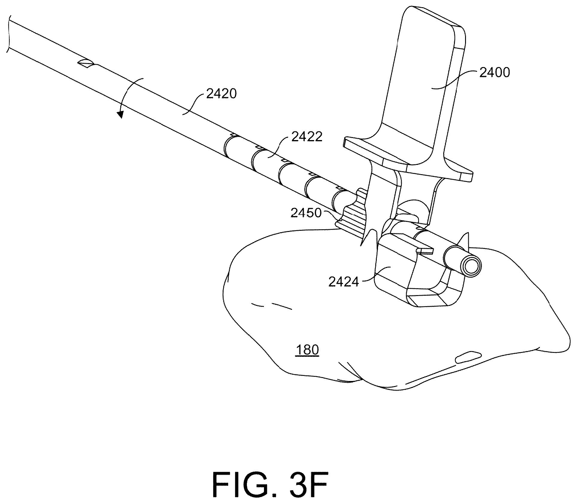 Patent US12167861 Figure 17 – Tendon harvesting system
