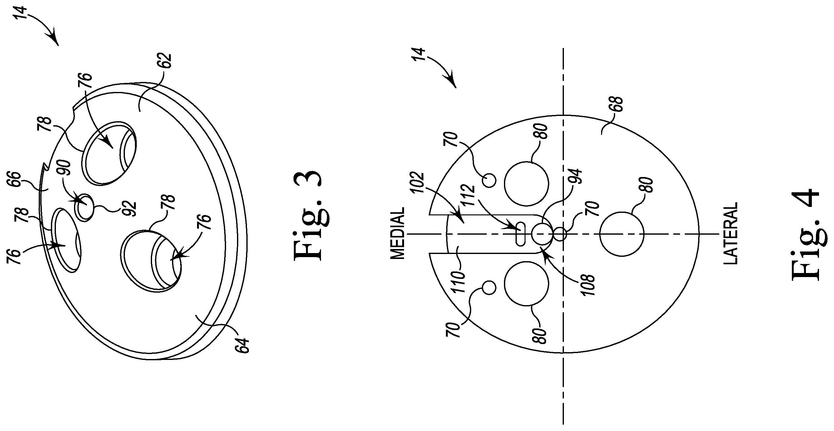 Patent US12167862 Figure 3 – Orthopaedic surgical instrument system for implanting a prosthetic patella component and method of use