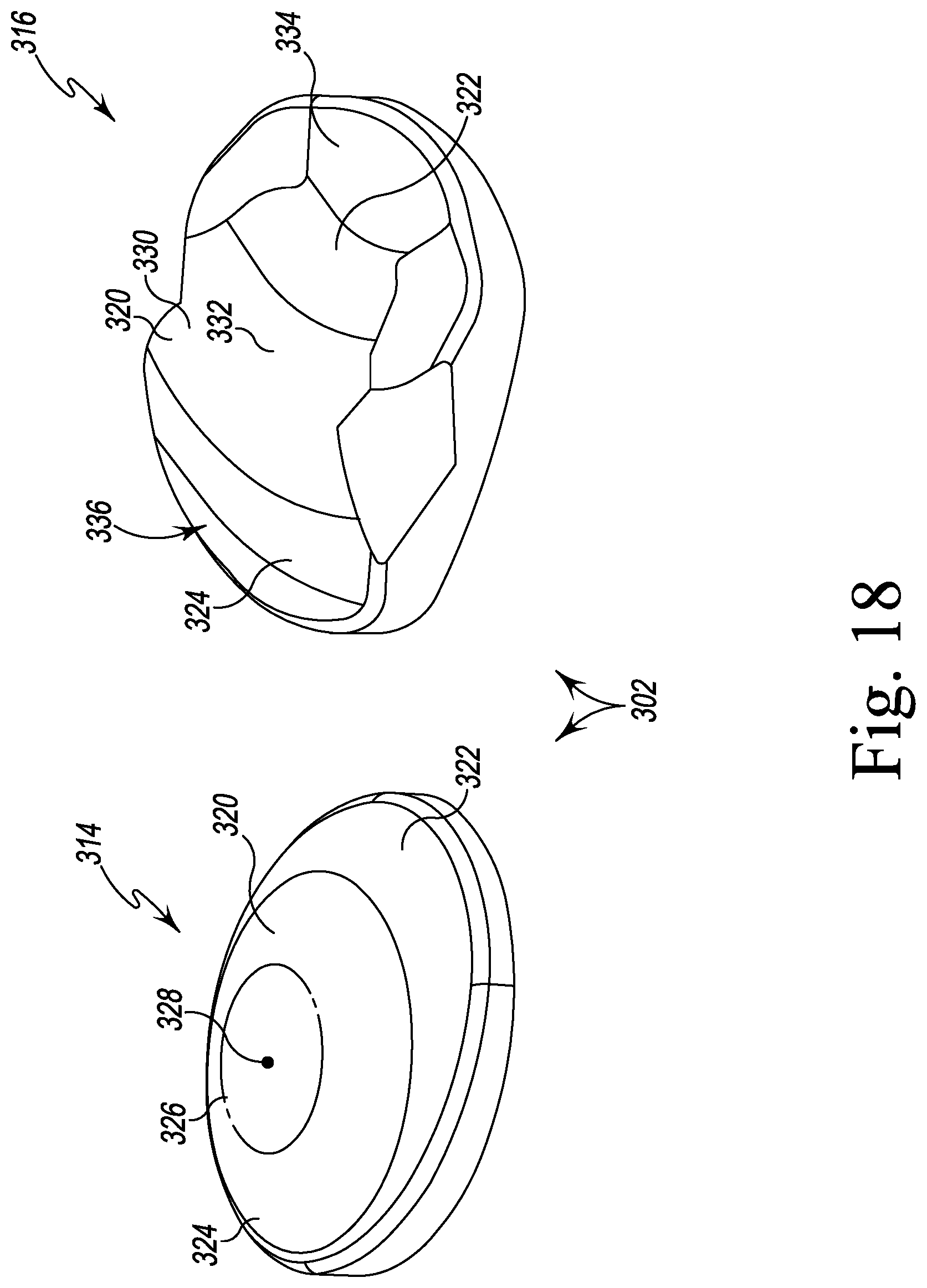 Patent US12167862 Figure 11 – Orthopaedic surgical instrument system for implanting a prosthetic patella component and method of use