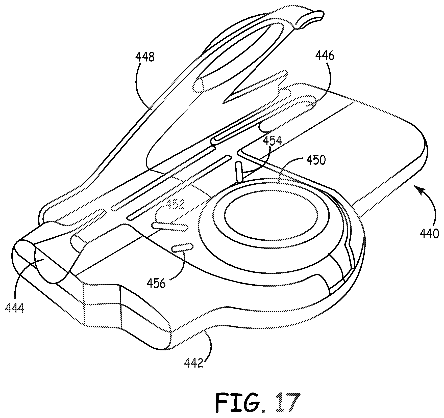 Patent US12167863 Figure 19 – Aspiration catheters for thrombus removal