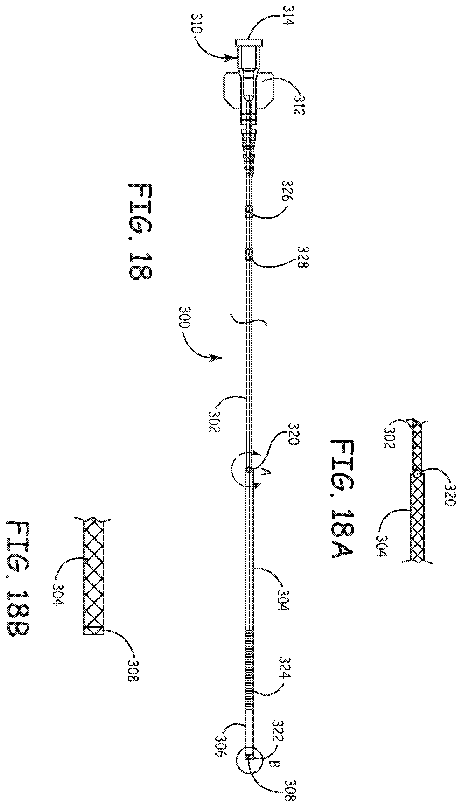 Patent US12167863 Figure 20 – Aspiration catheters for thrombus removal