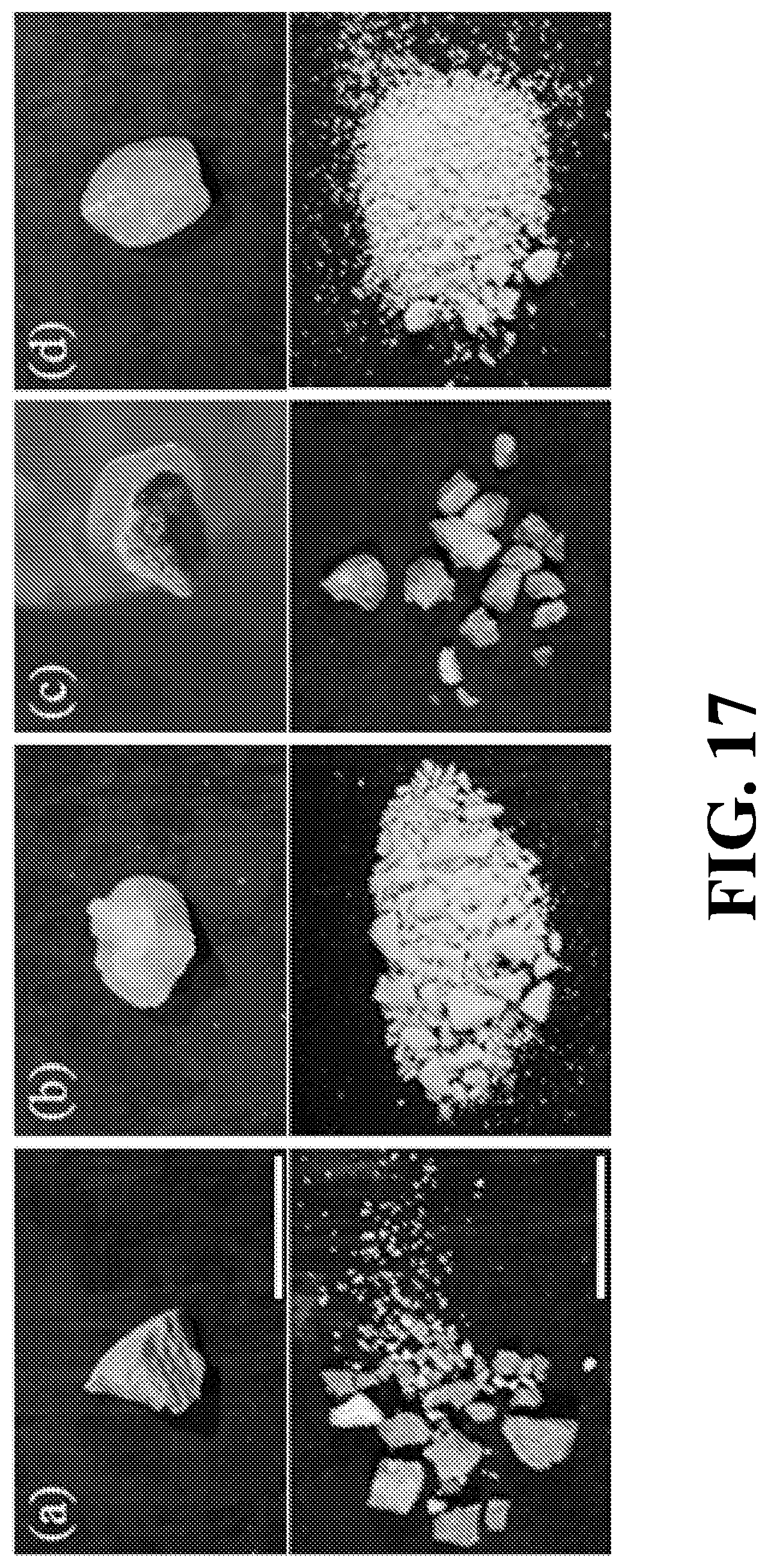 Patent US12167864 Figure 20 – Noninvasive fragmentation of urinary tract stones with focused ultrasound