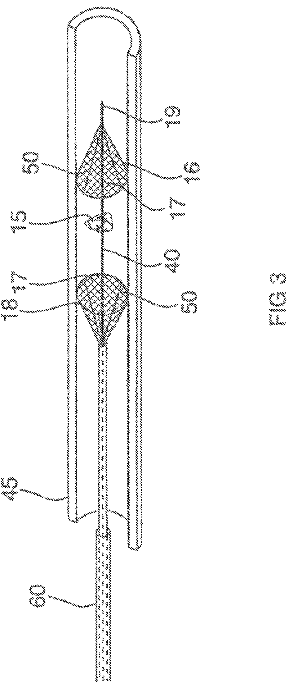 Patent US12167865 Figure 2 – Minimally invasive thrombectomy
