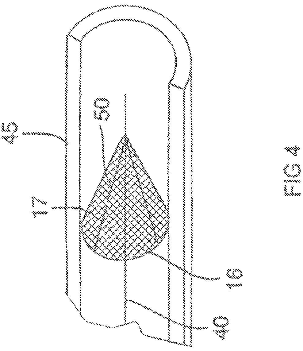 Patent US12167865 Figure 3 – Minimally invasive thrombectomy