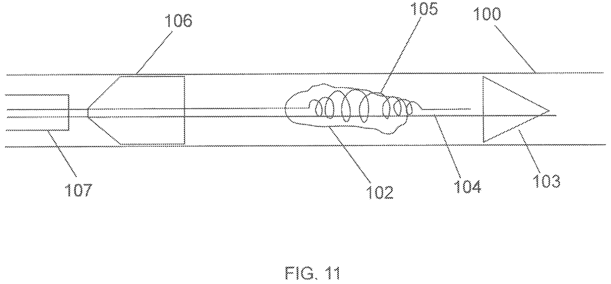 Patent US12167865 Figure 9 – Minimally invasive thrombectomy
