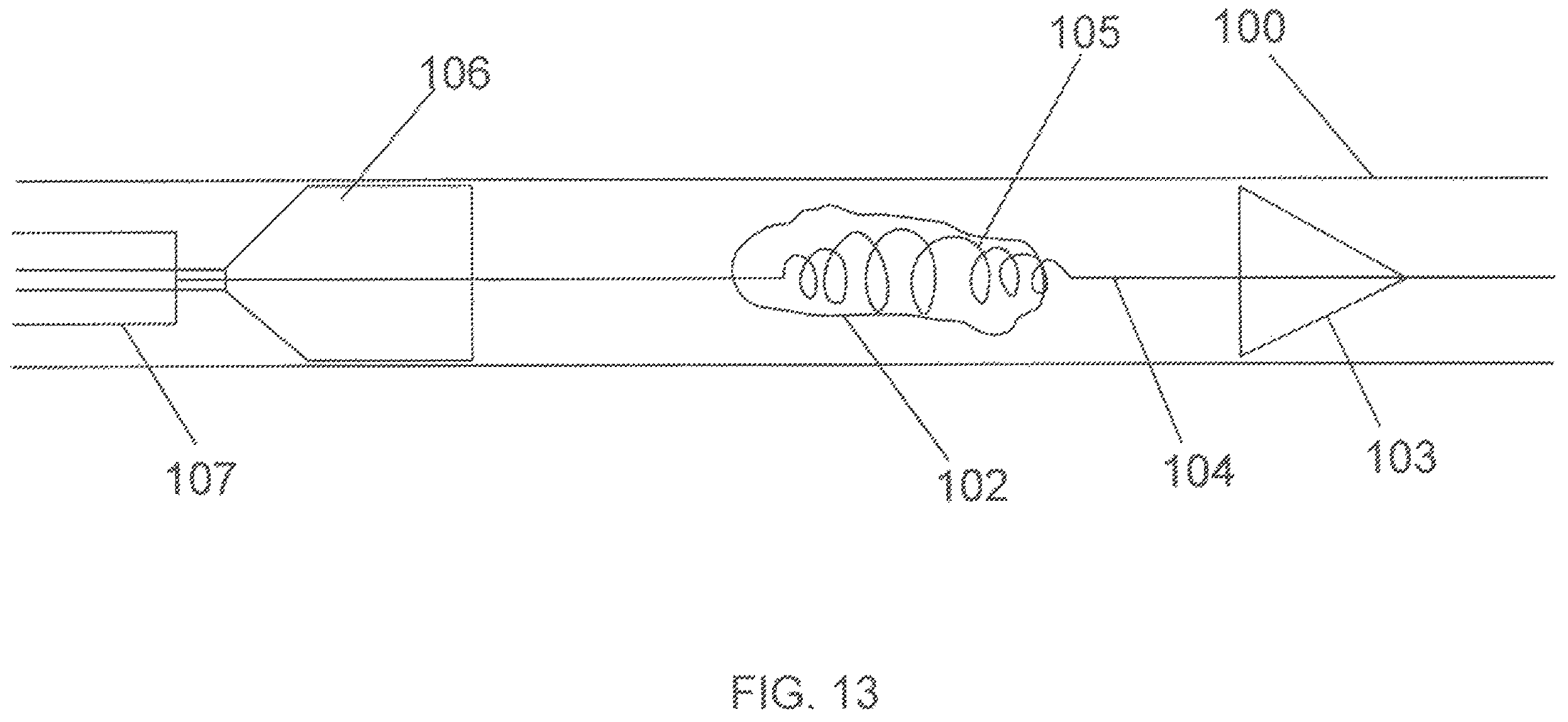 Patent US12167865 Figure 11 – Minimally invasive thrombectomy