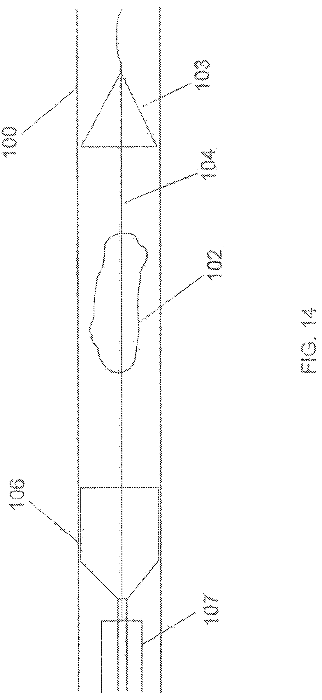 Patent US12167865 Figure 12 – Minimally invasive thrombectomy