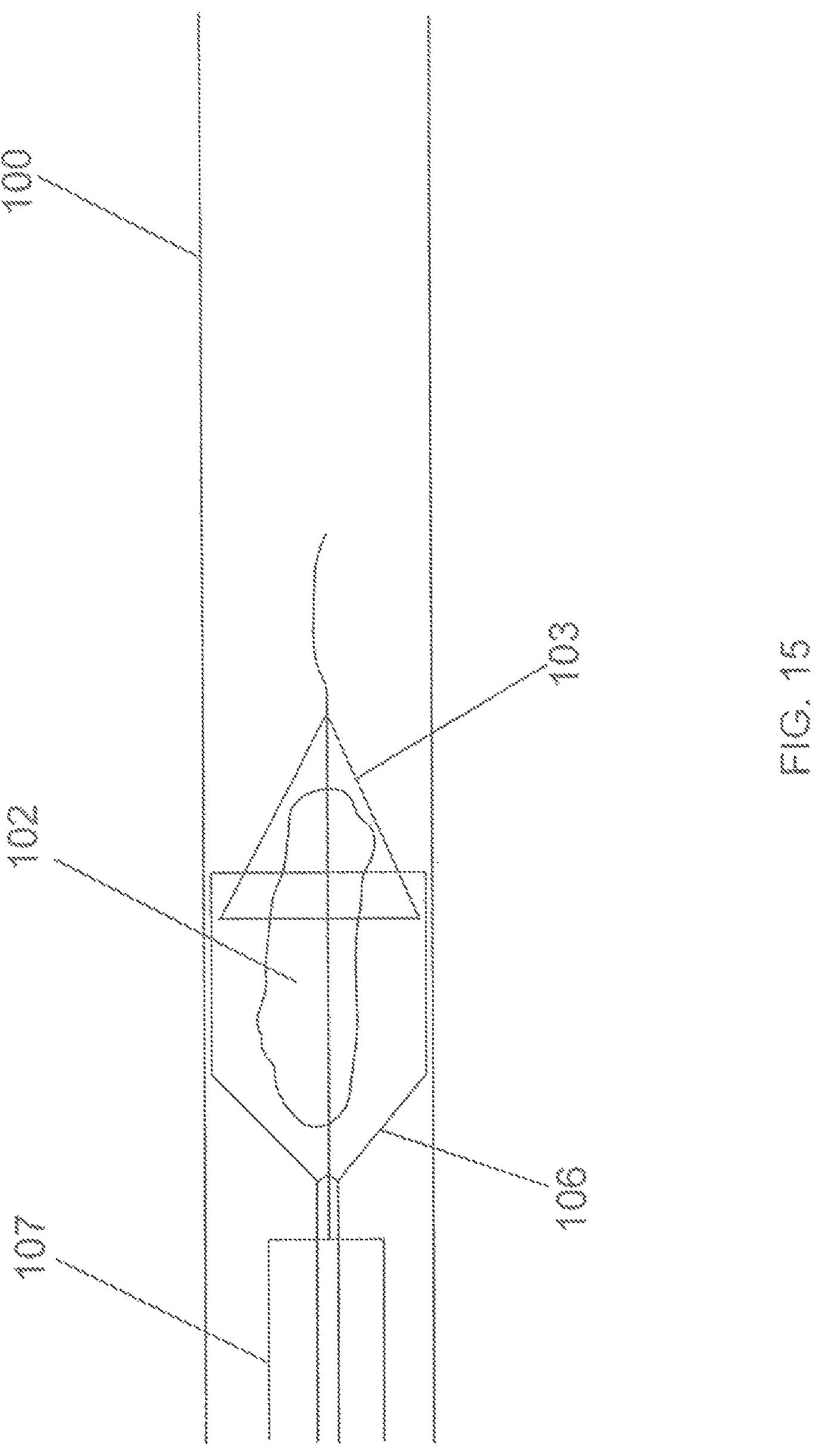 Patent US12167865 Figure 13 – Minimally invasive thrombectomy