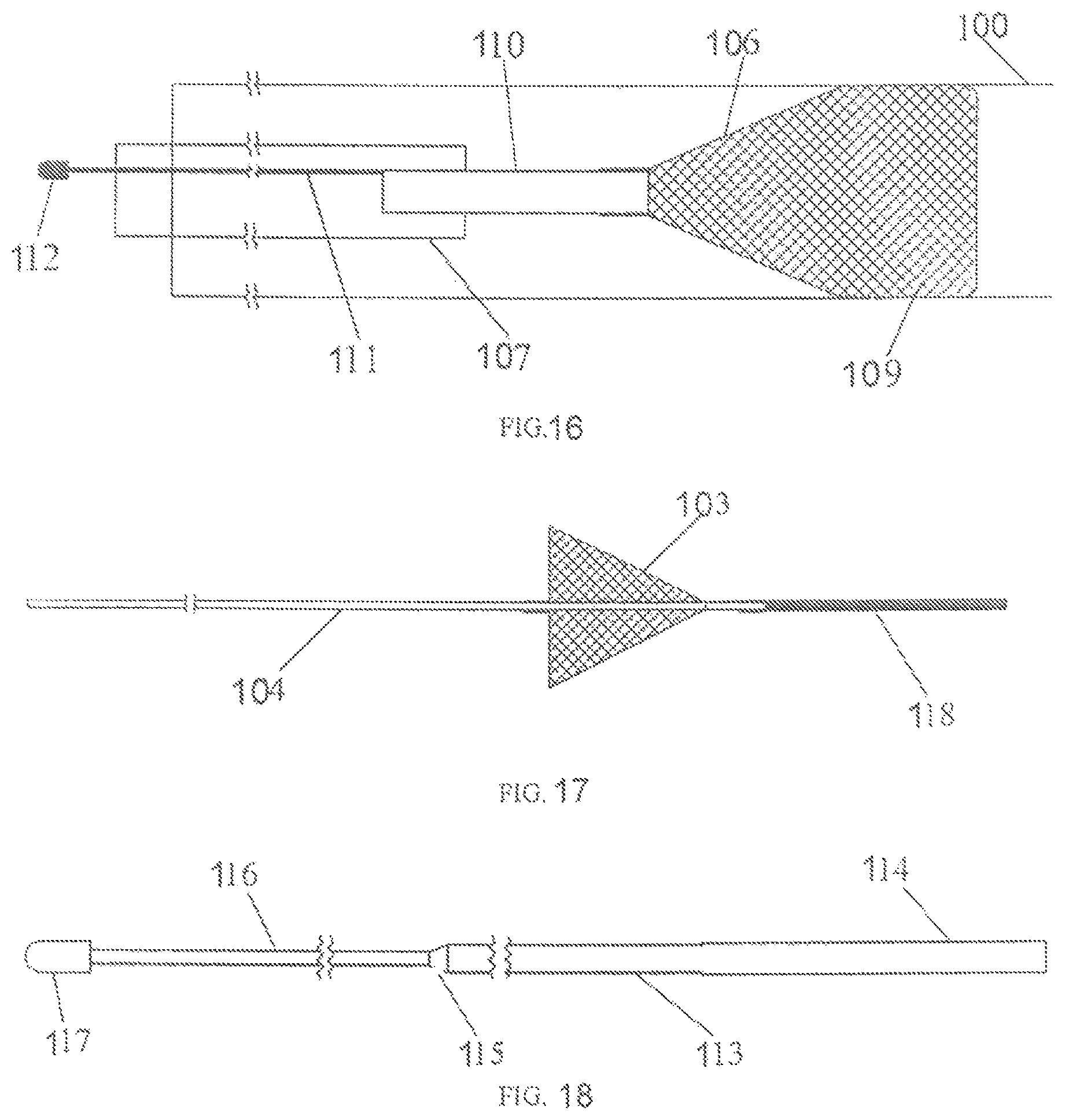 Patent US12167865 Figure 14 – Minimally invasive thrombectomy