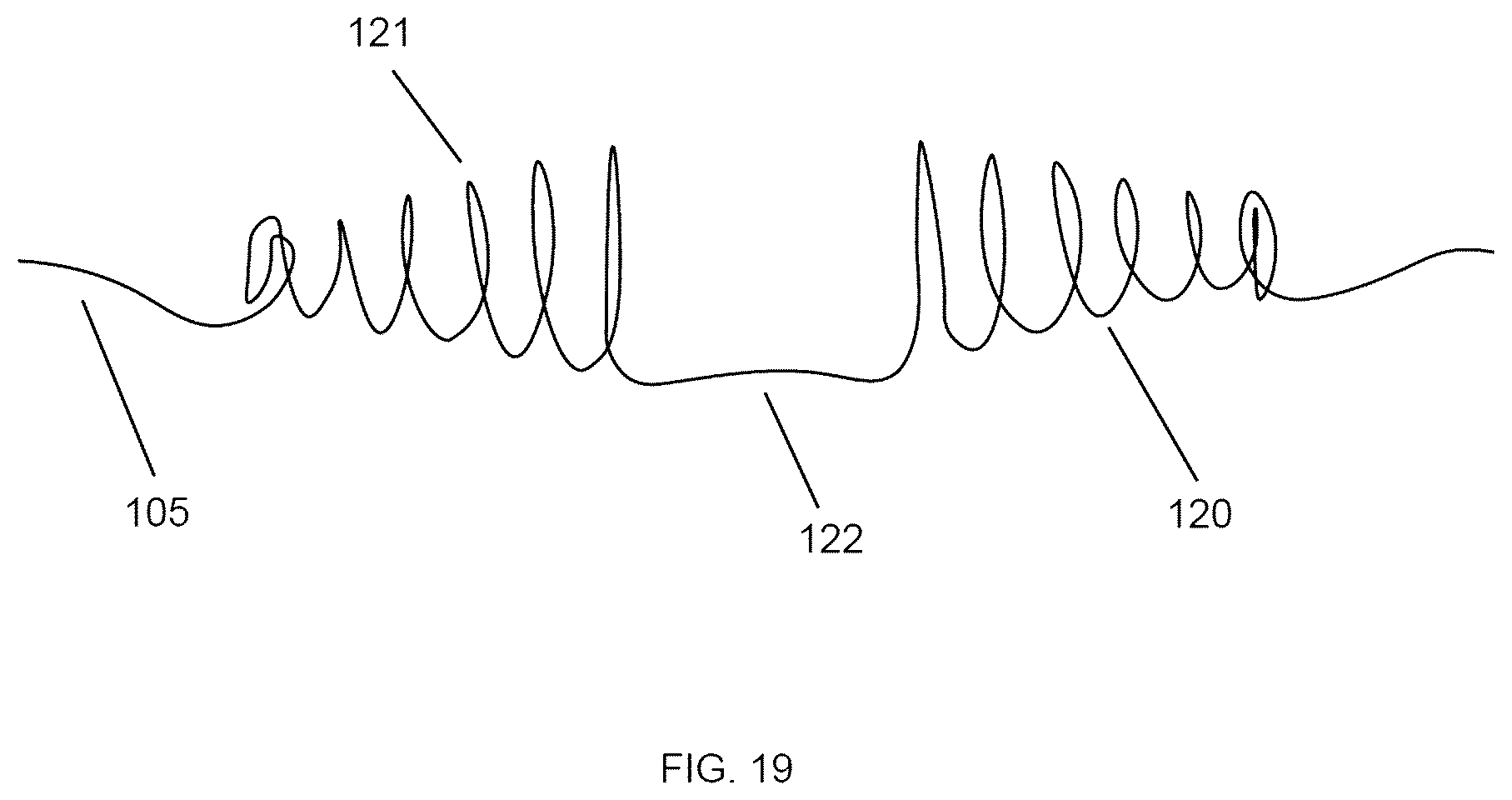 Patent US12167865 Figure 15 – Minimally invasive thrombectomy