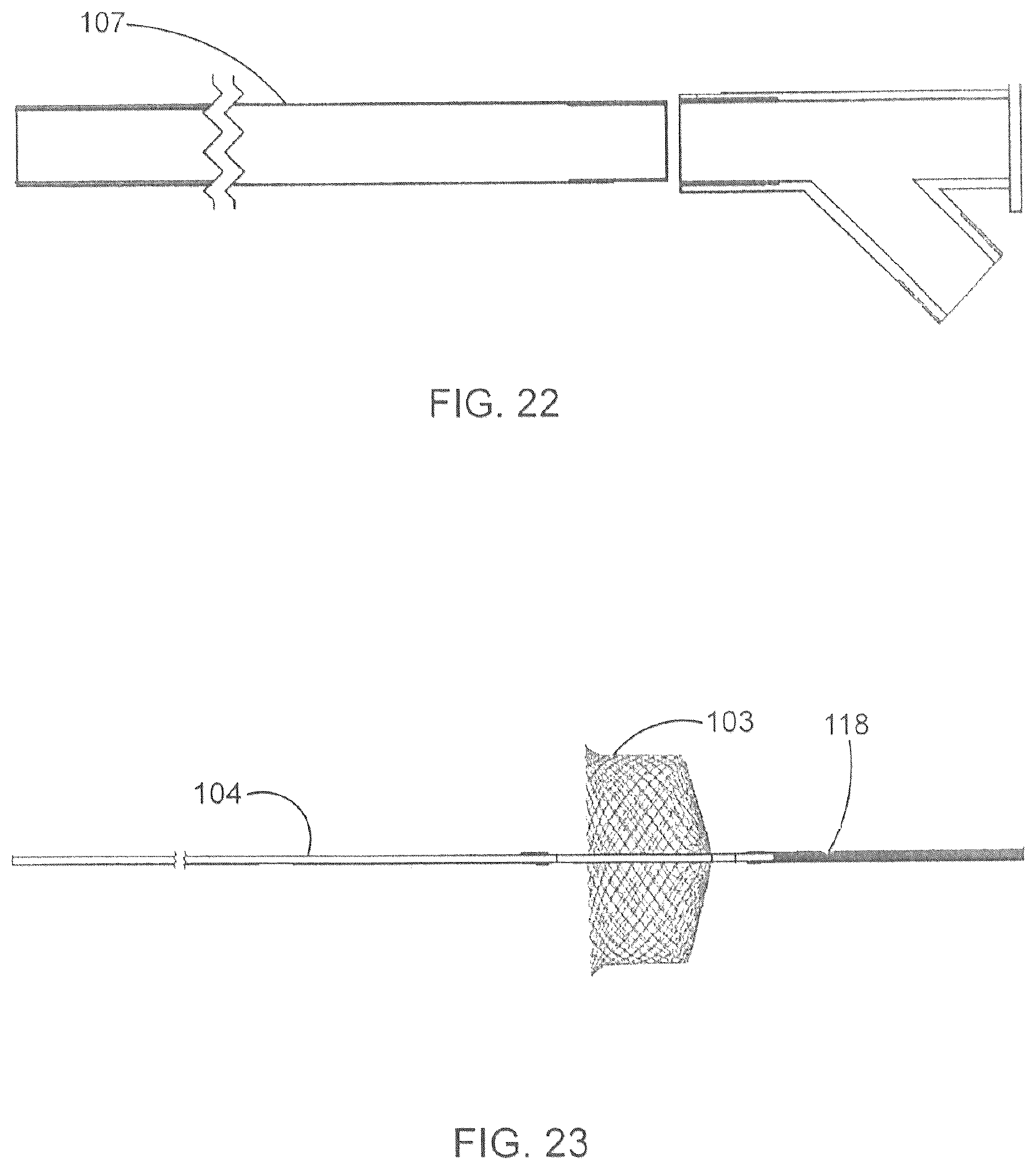 Patent US12167865 Figure 17 – Minimally invasive thrombectomy