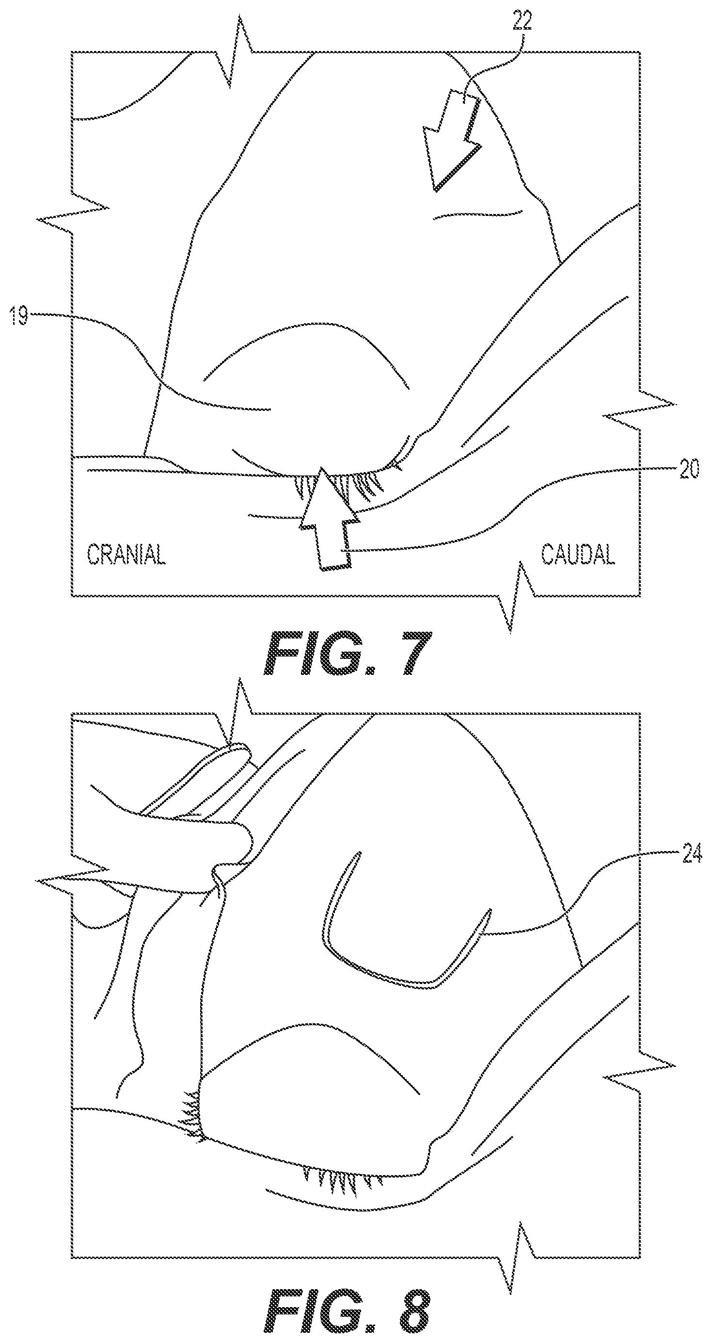 Patent US12167868 Figure 4 – Enucleation-exenteration approach of the camel eye via the supraorbital fossa