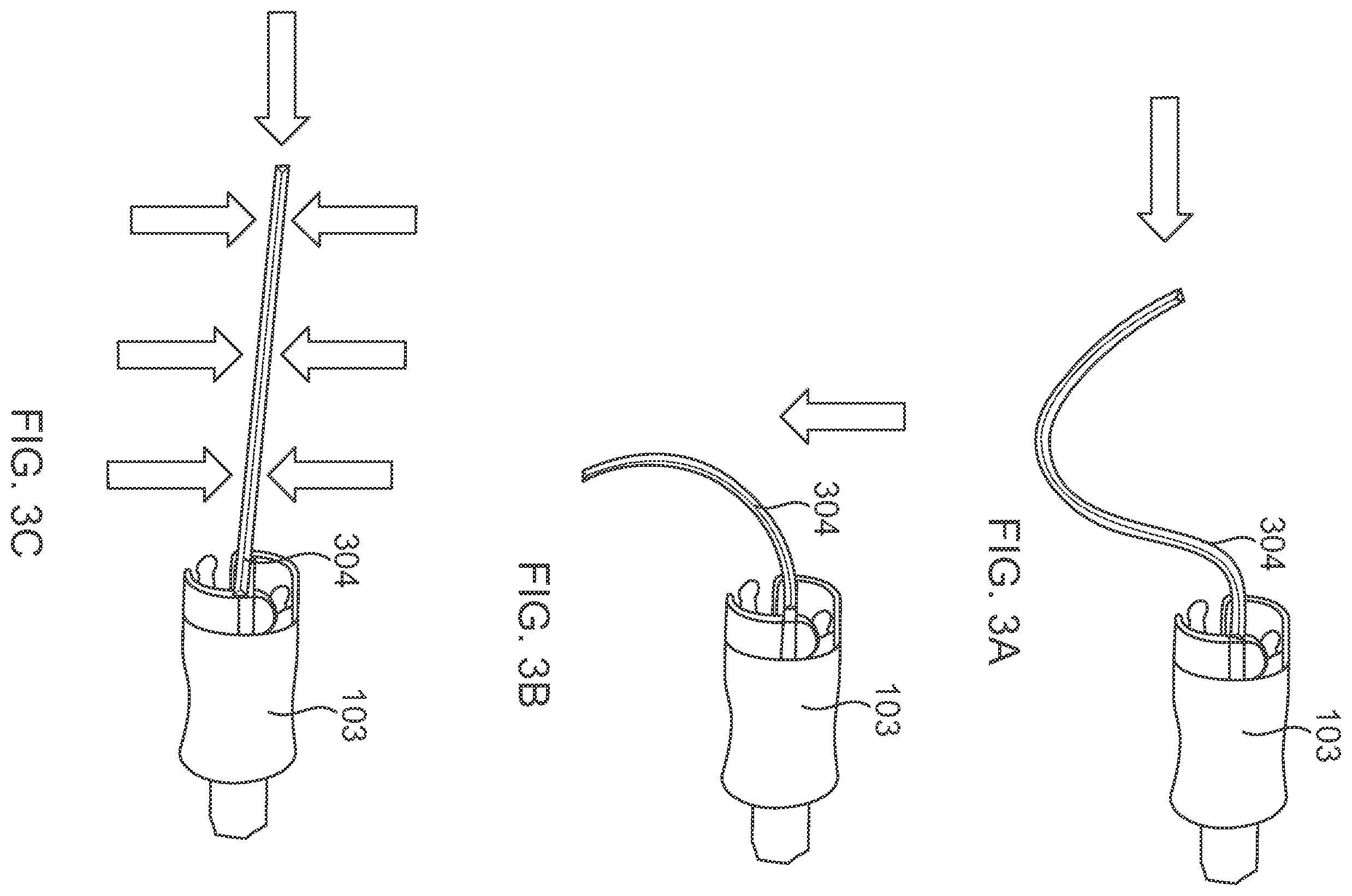 Patent US12167869 Figure 5 – Flexible intraosseous obturator