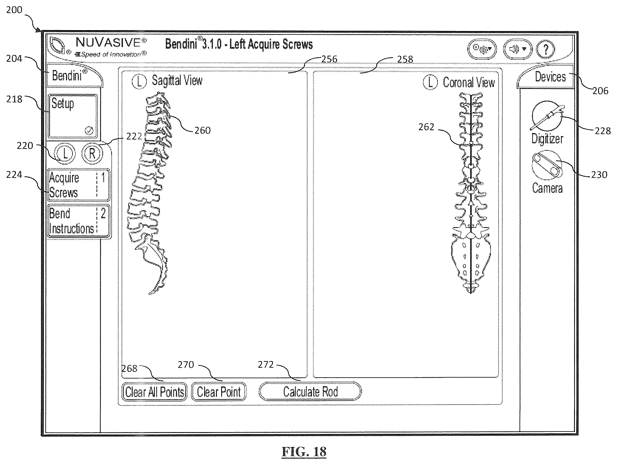 Patent US12167870 Figure 15 – Systems and methods for planning, performing, and assessing spinal correction during surgery