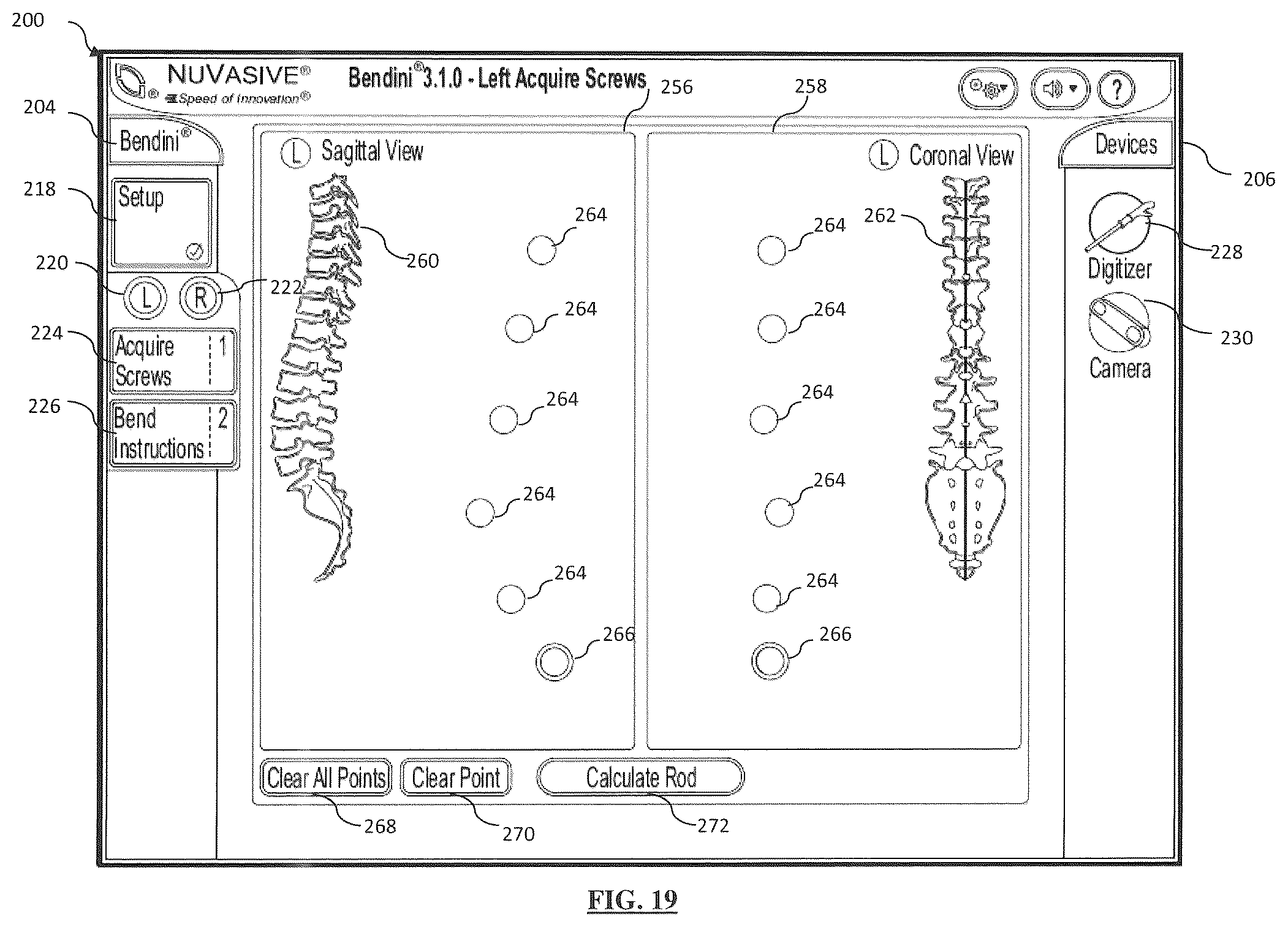Patent US12167870 Figure 16 – Systems and methods for planning, performing, and assessing spinal correction during surgery