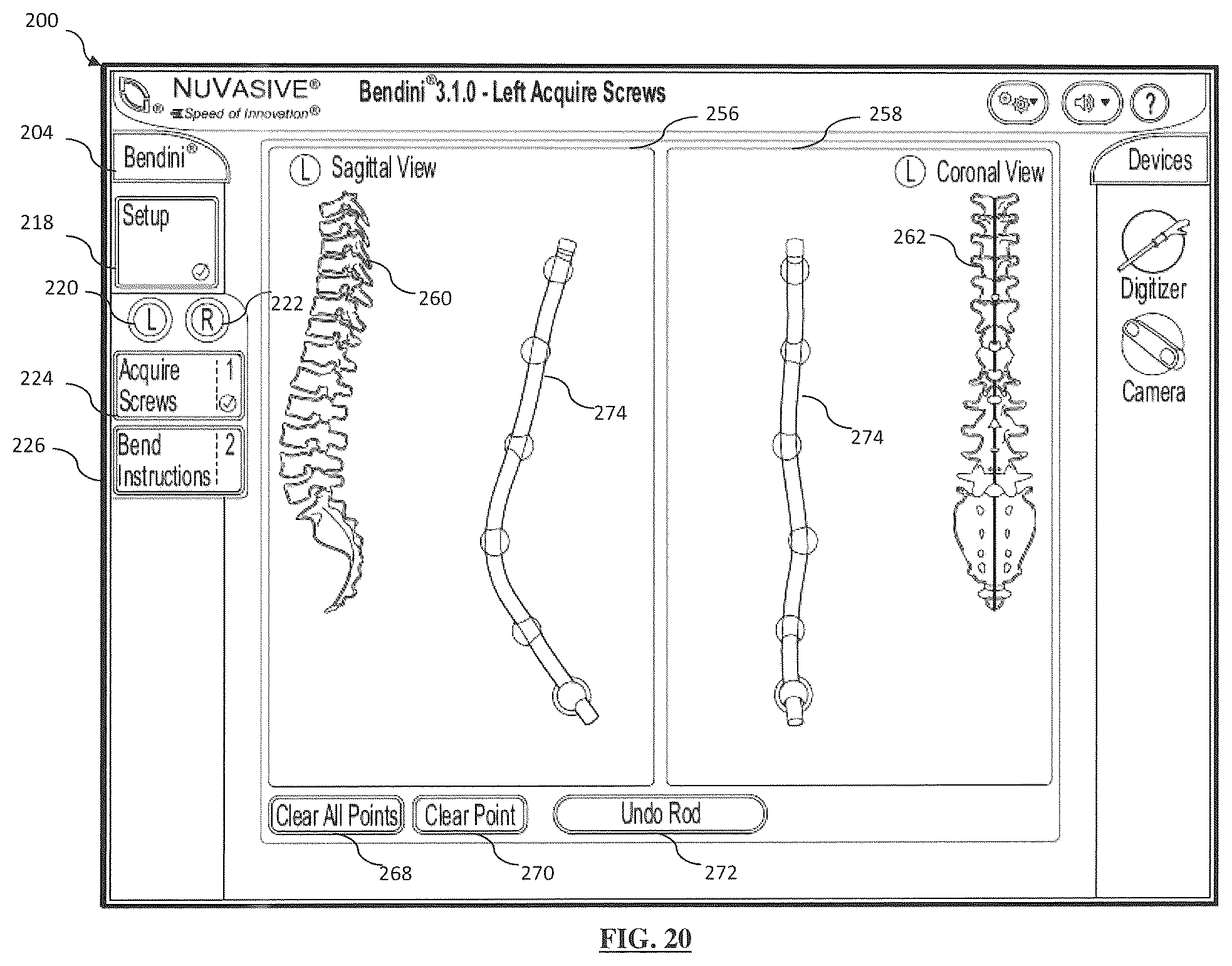 Patent US12167870 Figure 17 – Systems and methods for planning, performing, and assessing spinal correction during surgery