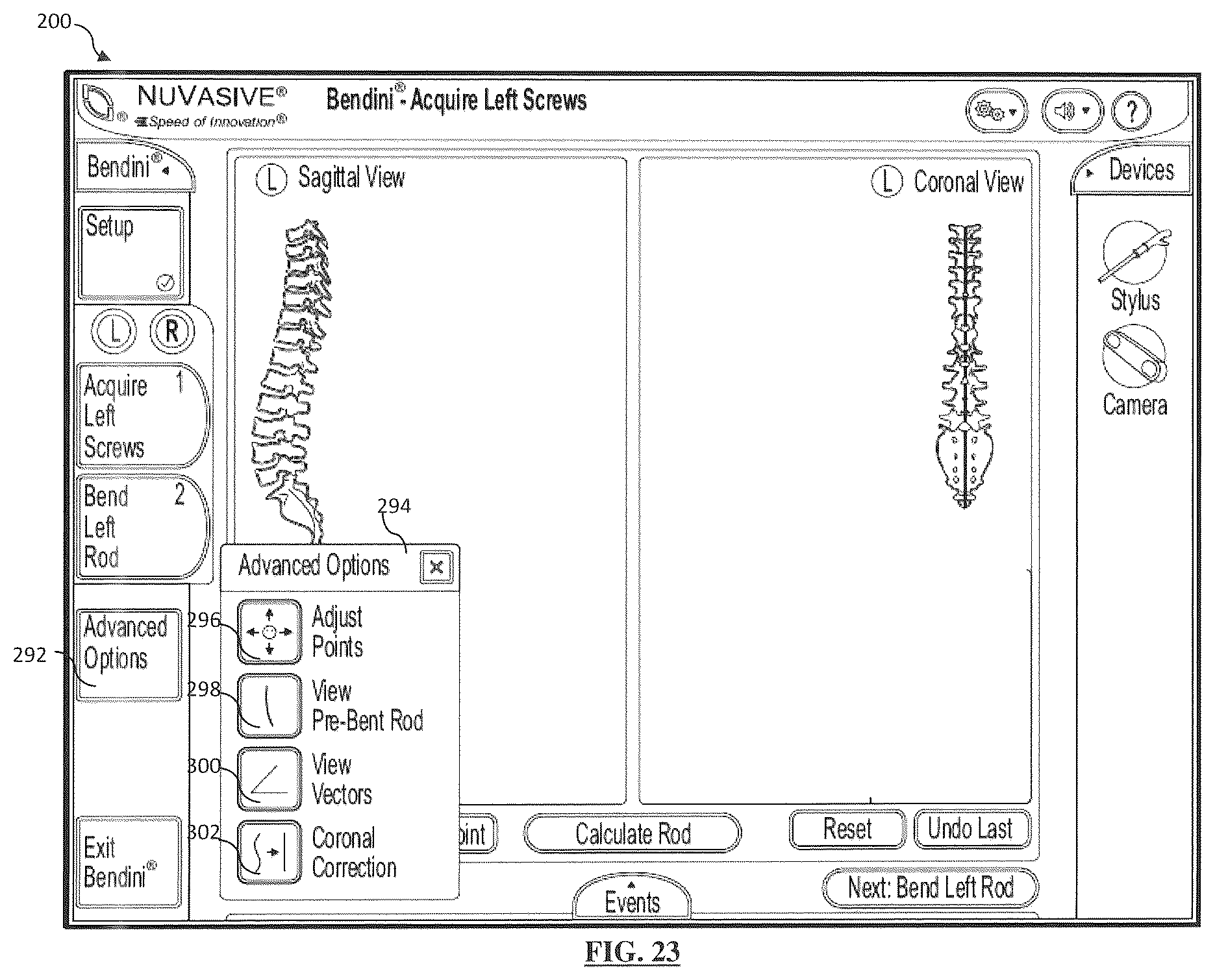 Patent US12167870 Figure 20 – Systems and methods for planning, performing, and assessing spinal correction during surgery
