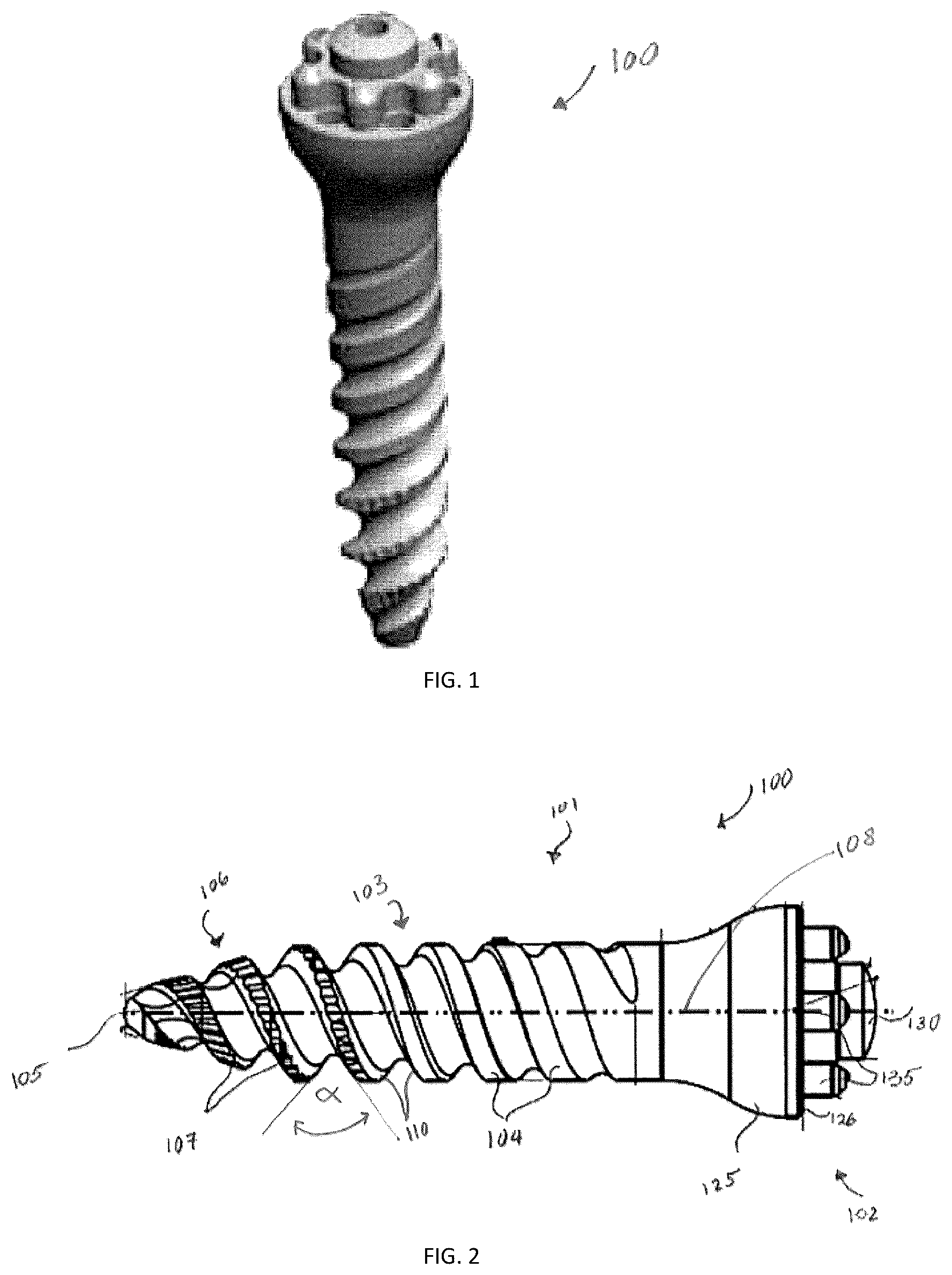 Patent US12167871 Figure 1 – Spinal fastener with serrated thread