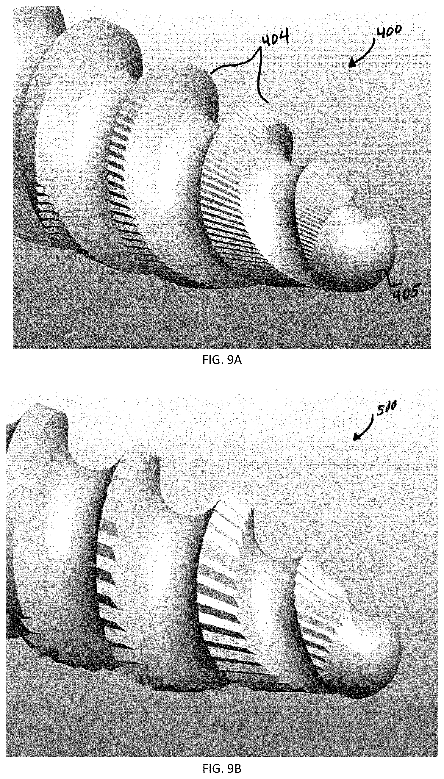 Patent US12167871 Figure 5 – Spinal fastener with serrated thread