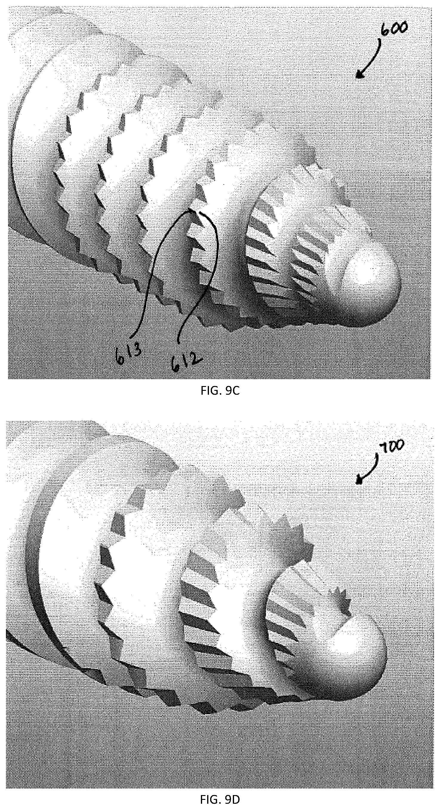 Patent US12167871 Figure 6 – Spinal fastener with serrated thread