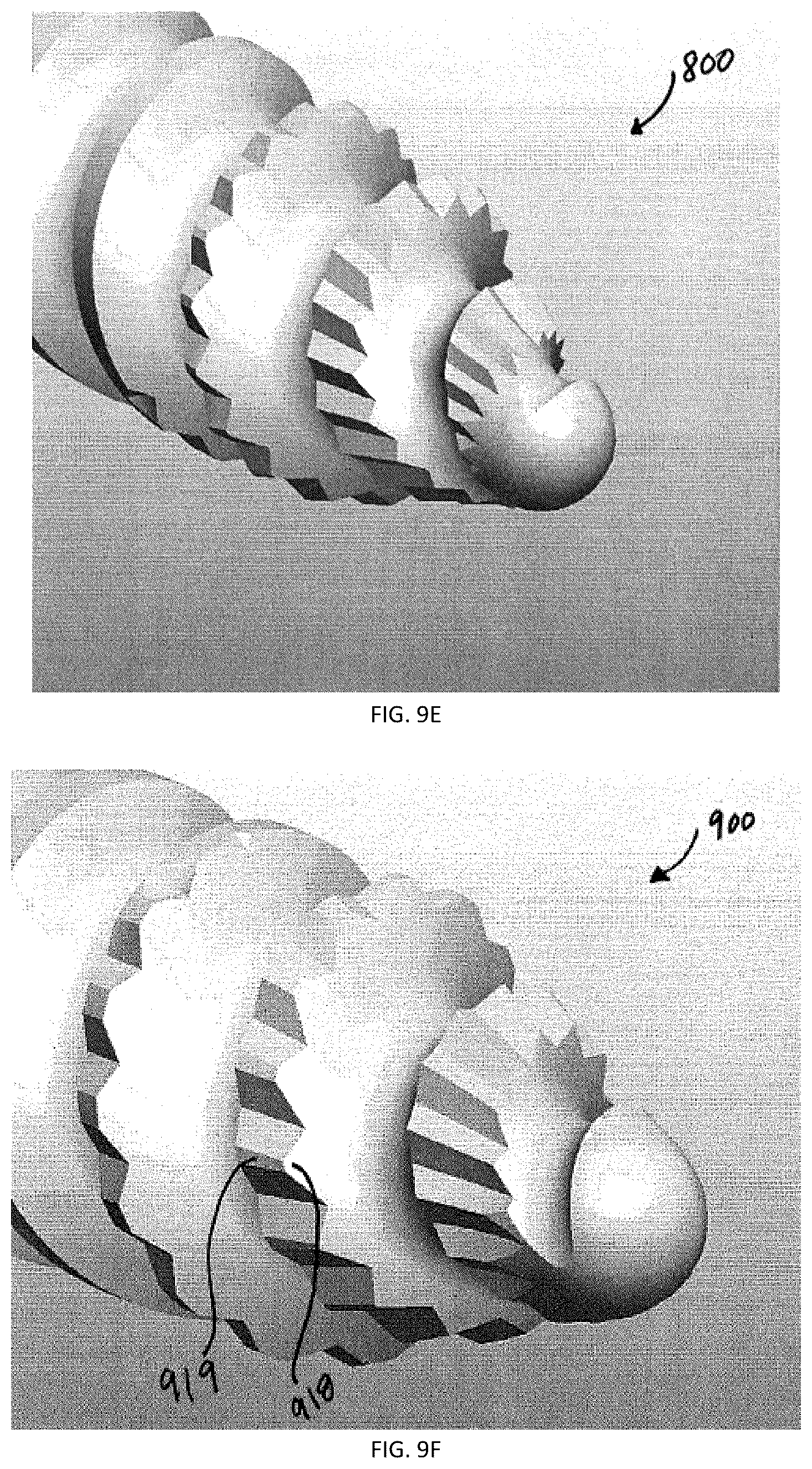 Patent US12167871 Figure 7 – Spinal fastener with serrated thread