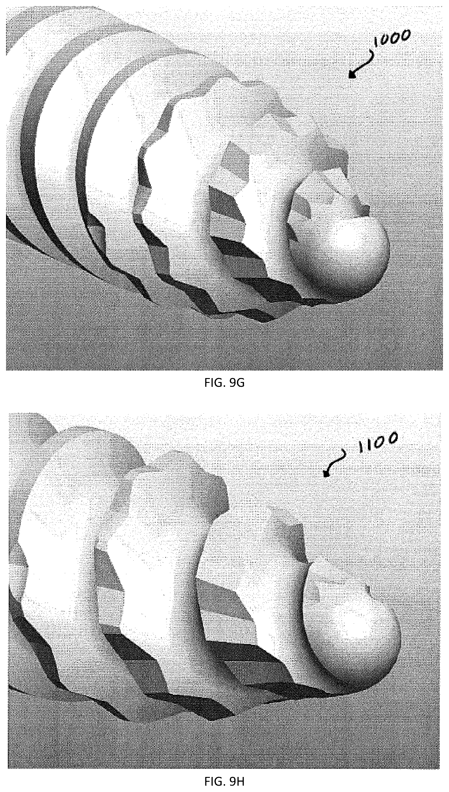 Patent US12167871 Figure 8 – Spinal fastener with serrated thread