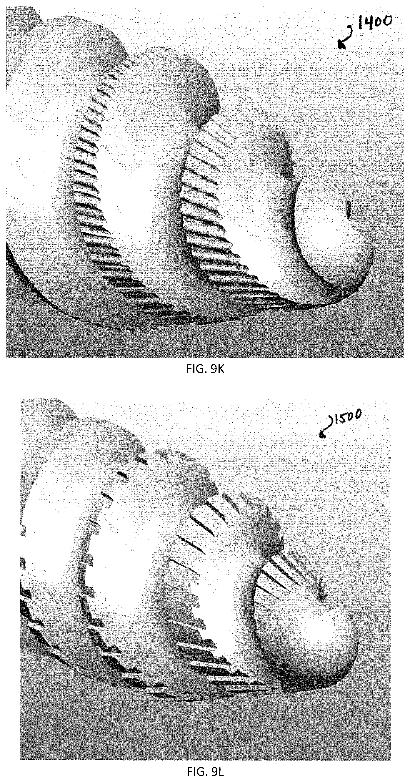 Patent US12167871 Figure 10 – Spinal fastener with serrated thread