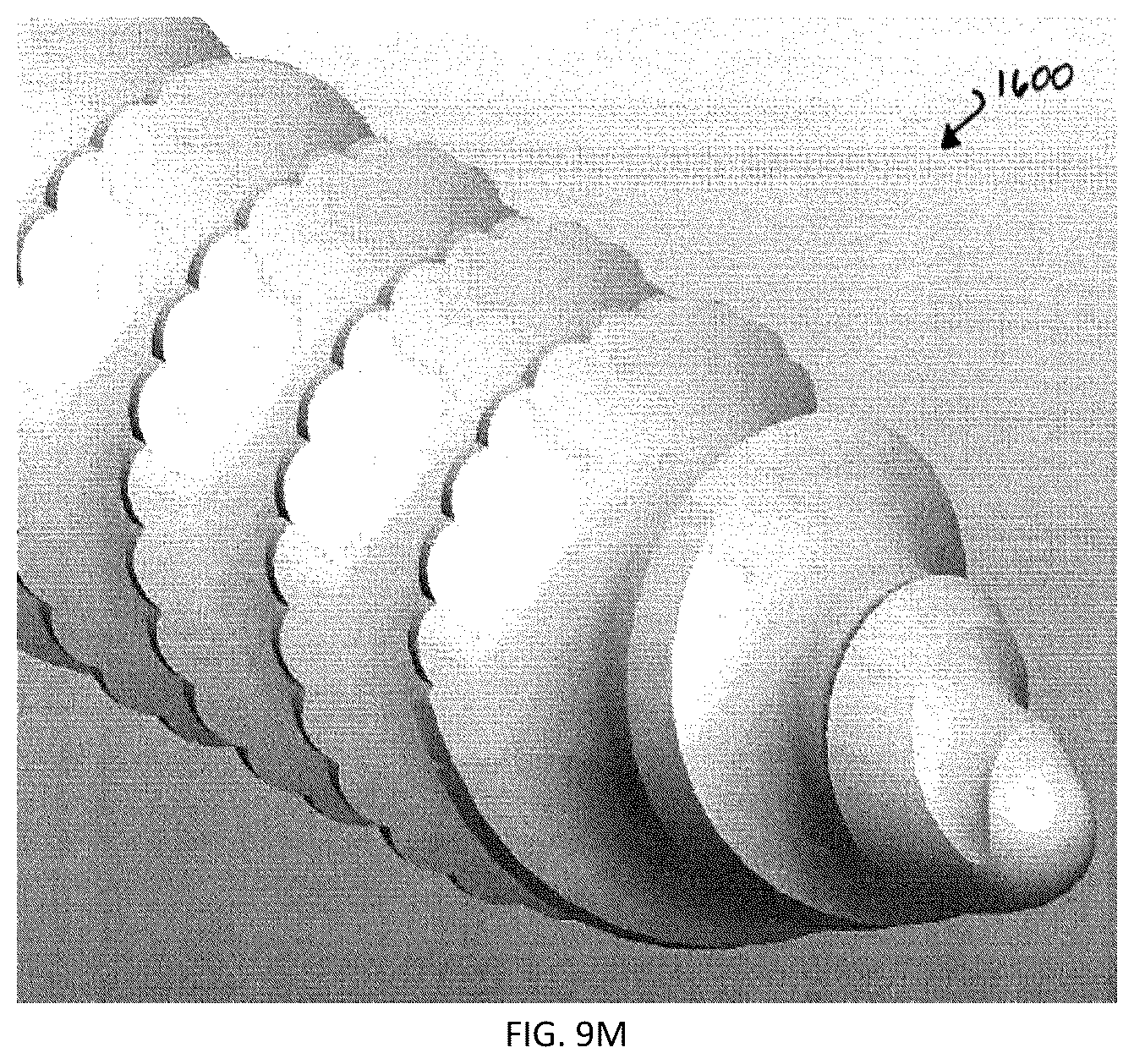 Patent US12167871 Figure 11 – Spinal fastener with serrated thread