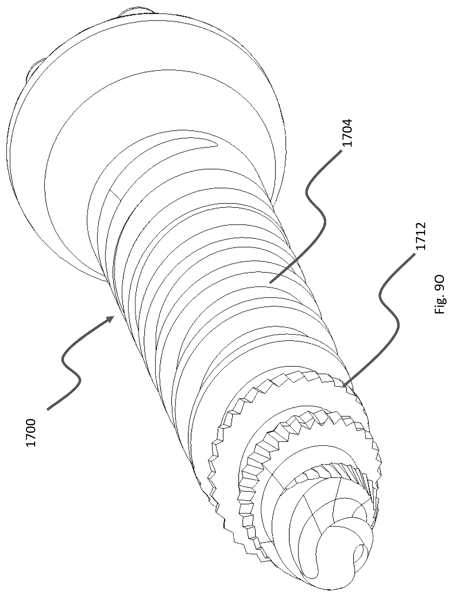 Patent US12167871 Figure 13 – Spinal fastener with serrated thread