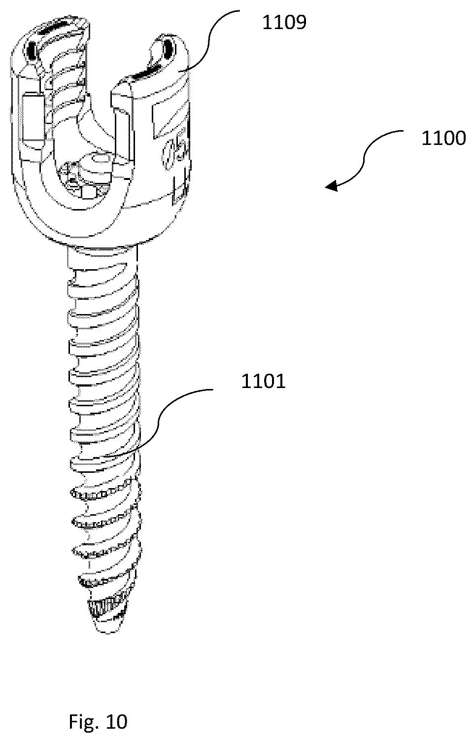 Patent US12167871 Figure 16 – Spinal fastener with serrated thread