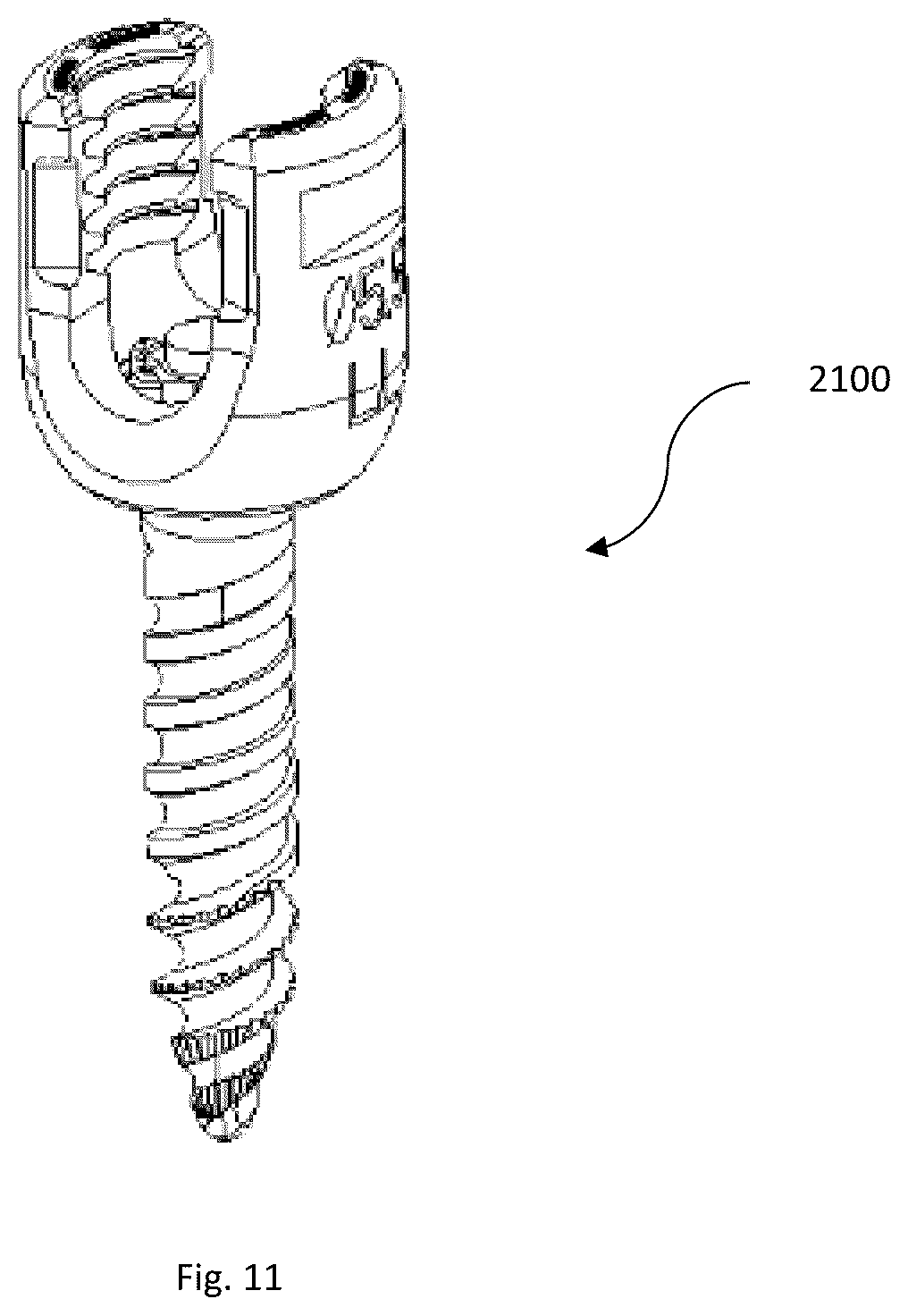 Patent US12167871 Figure 17 – Spinal fastener with serrated thread