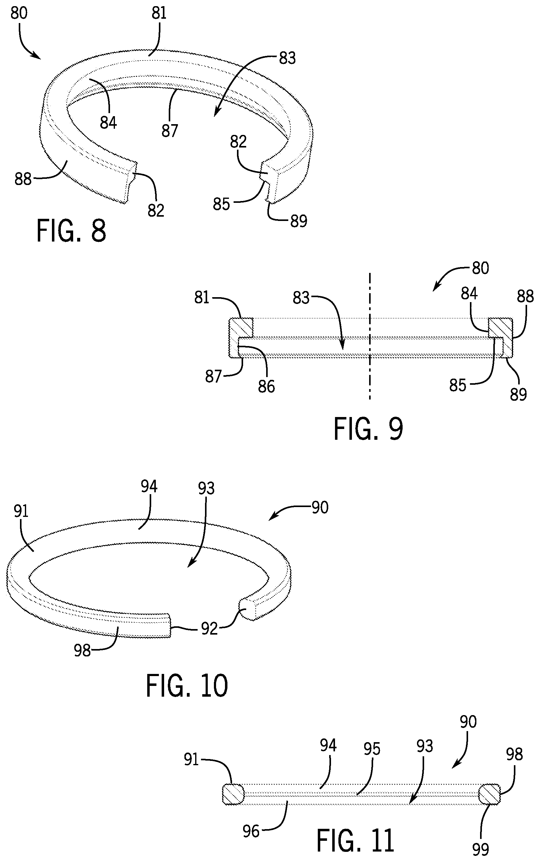 Patent US12167872 Figure 3 – Bottom loaded pivotal bone anchor assembly with locking and blocking rings and insert tool deployment