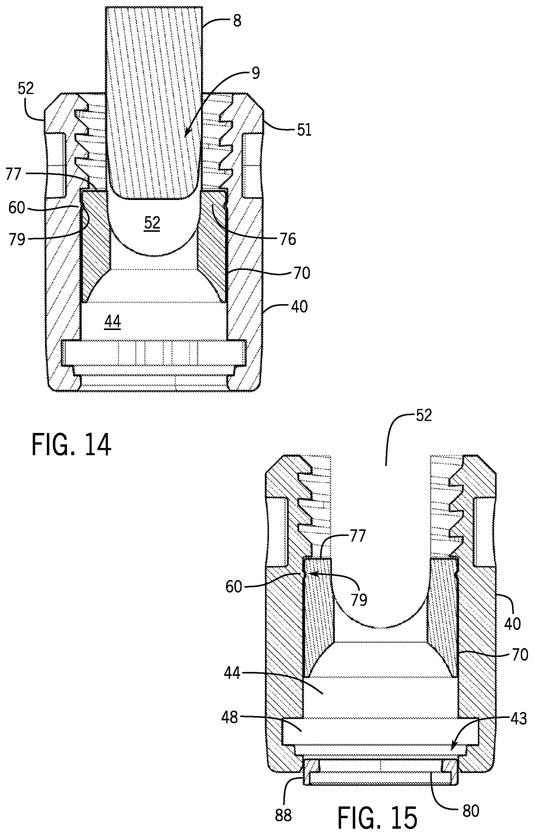Patent US12167872 Figure 5 – Bottom loaded pivotal bone anchor assembly with locking and blocking rings and insert tool deployment
