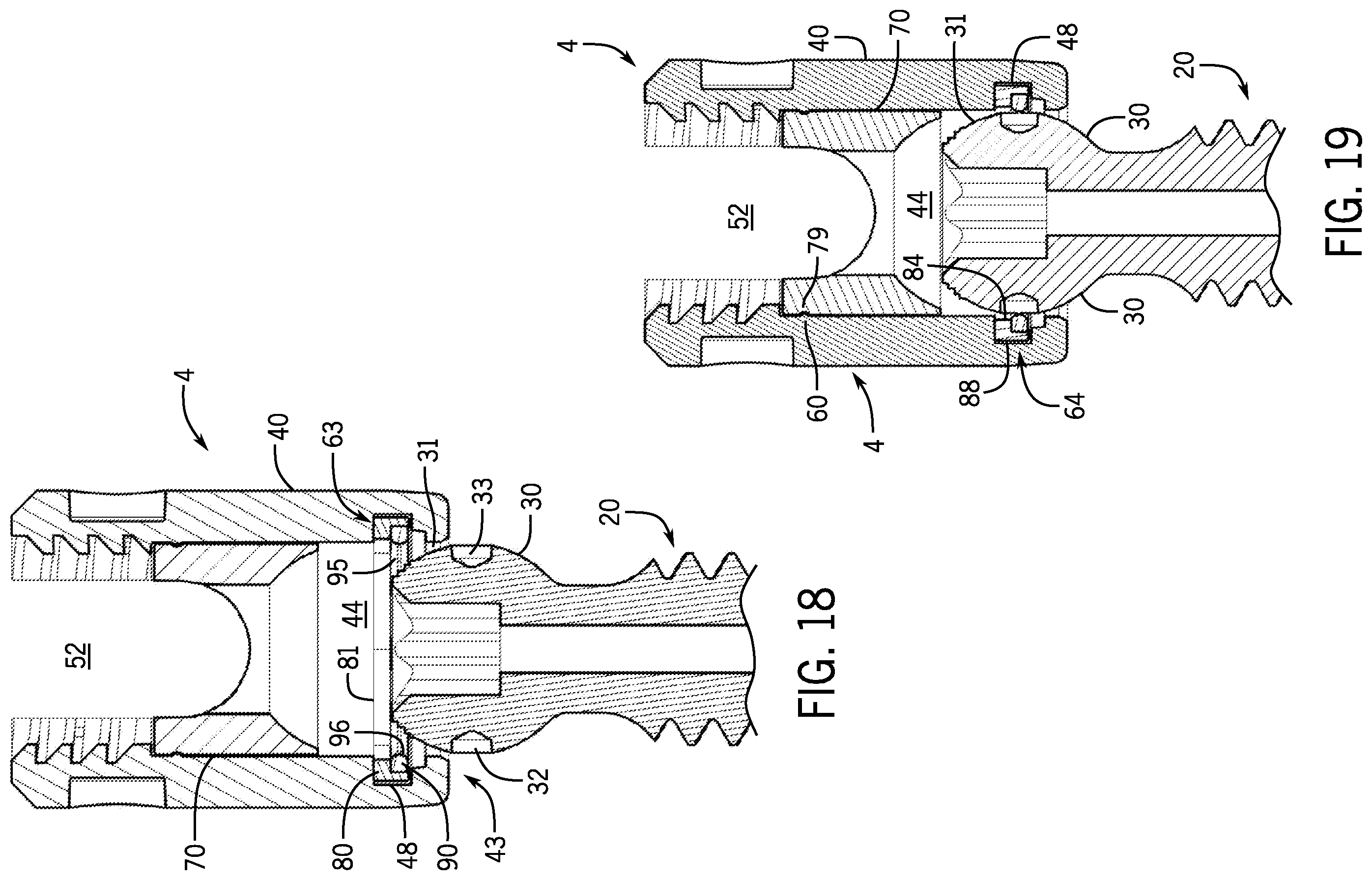 Patent US12167872 Figure 7 – Bottom loaded pivotal bone anchor assembly with locking and blocking rings and insert tool deployment