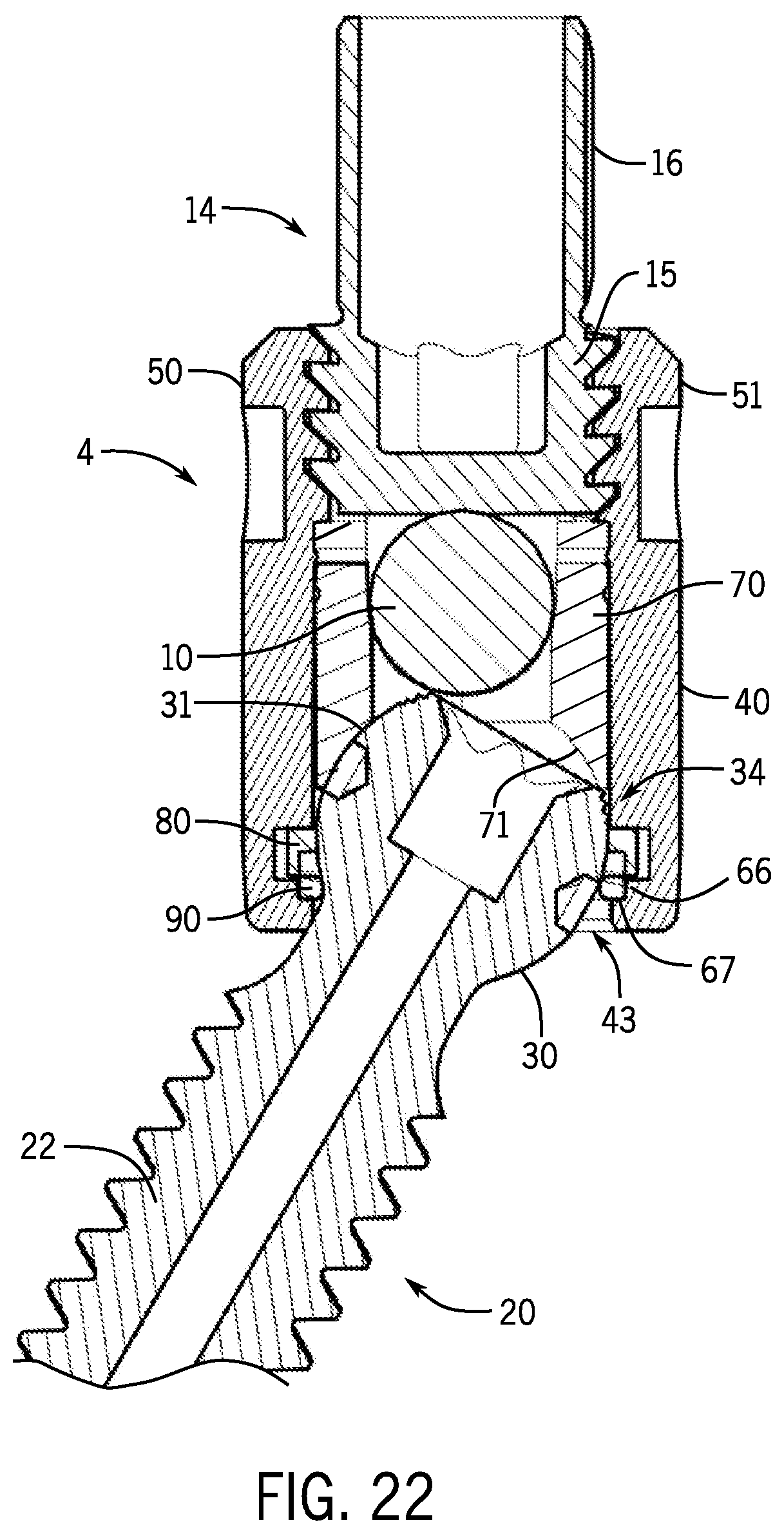 Patent US12167872 Figure 9 – Bottom loaded pivotal bone anchor assembly with locking and blocking rings and insert tool deployment