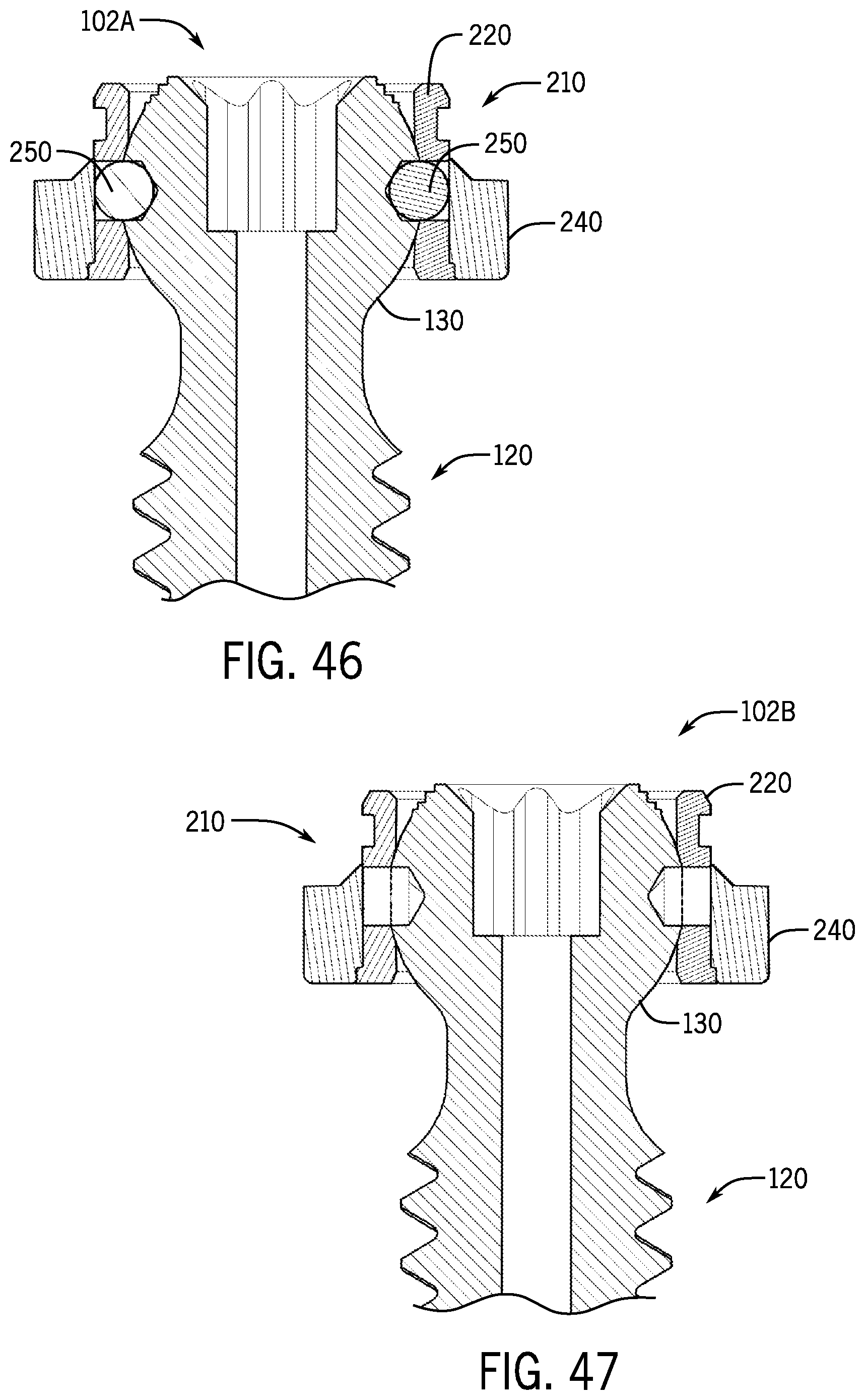 Patent US12167872 Figure 18 – Bottom loaded pivotal bone anchor assembly with locking and blocking rings and insert tool deployment