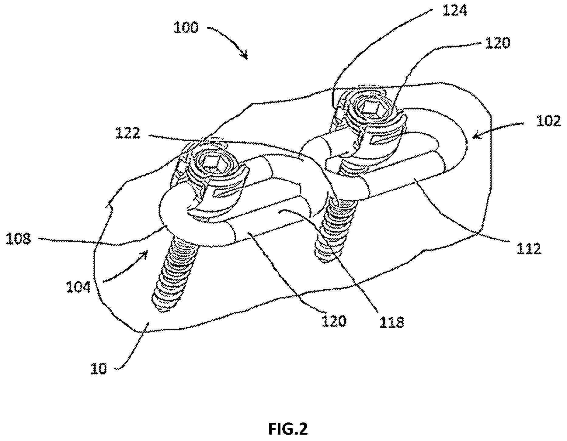 Patent US12167873 Figure 2 – Spinal fixation assembly