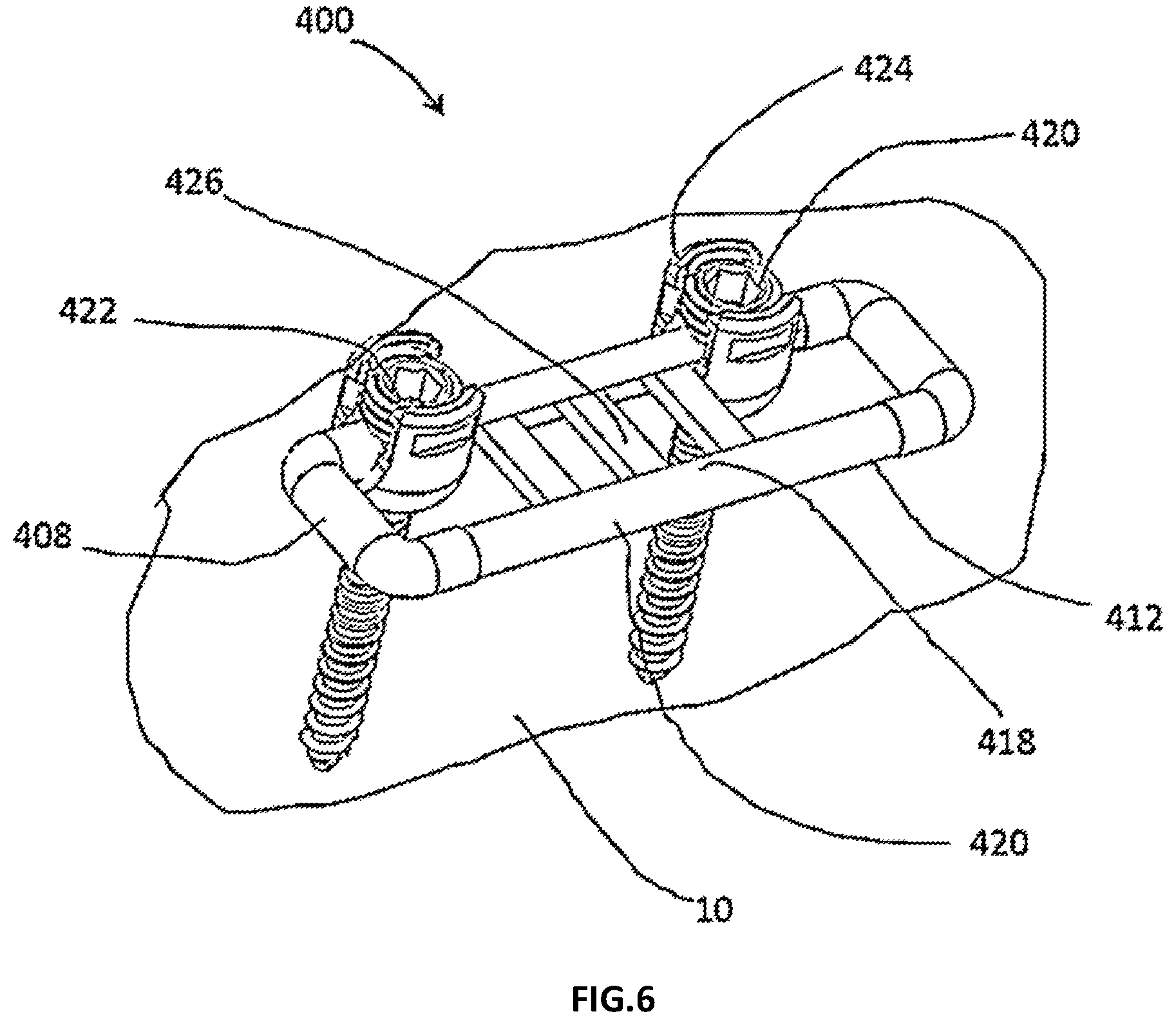 Patent US12167873 Figure 6 – Spinal fixation assembly