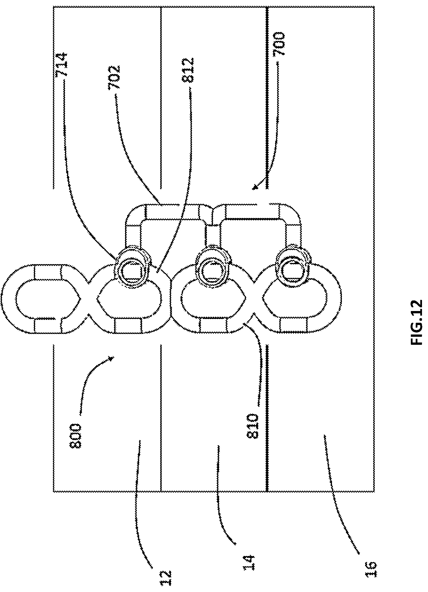 Patent US12167873 Figure 11 – Spinal fixation assembly